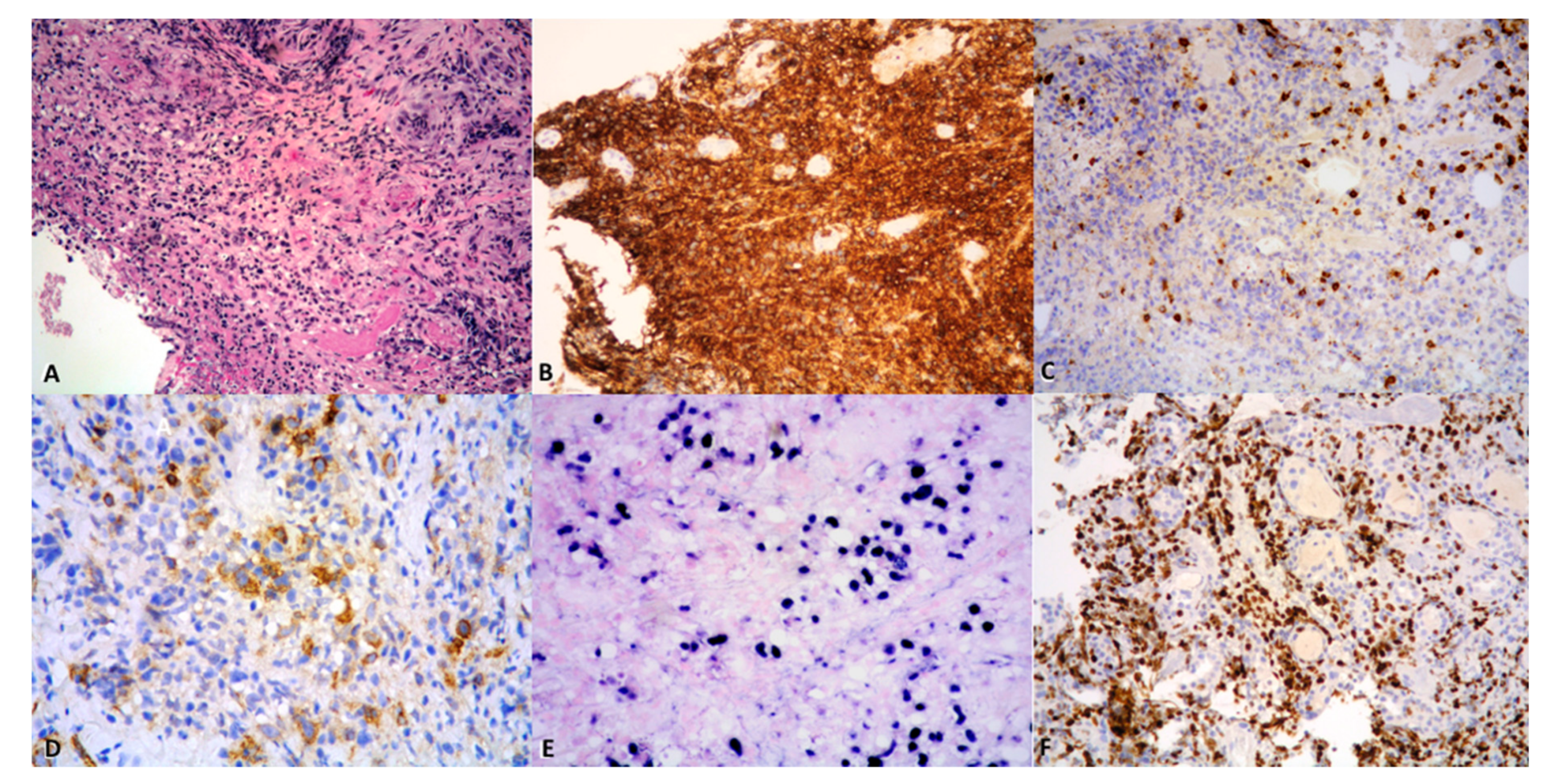 Cancers 13 00415 g004