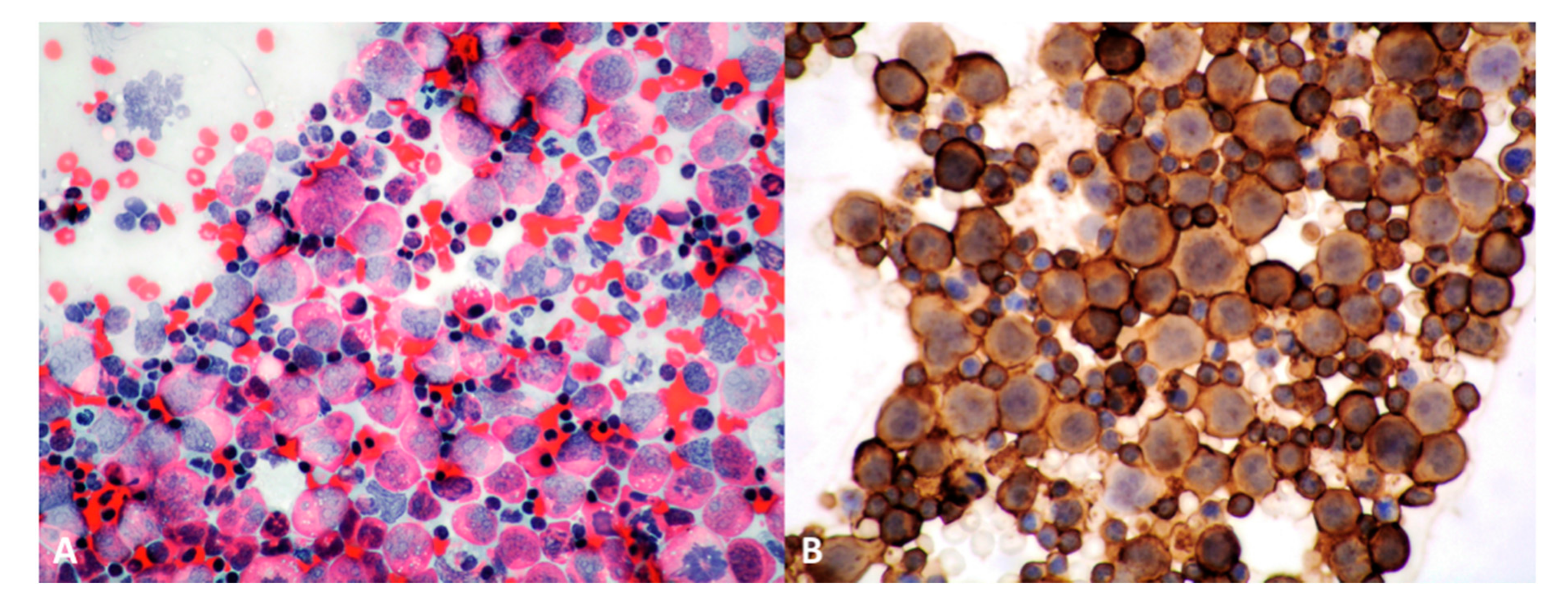 Cancers 13 00415 g005