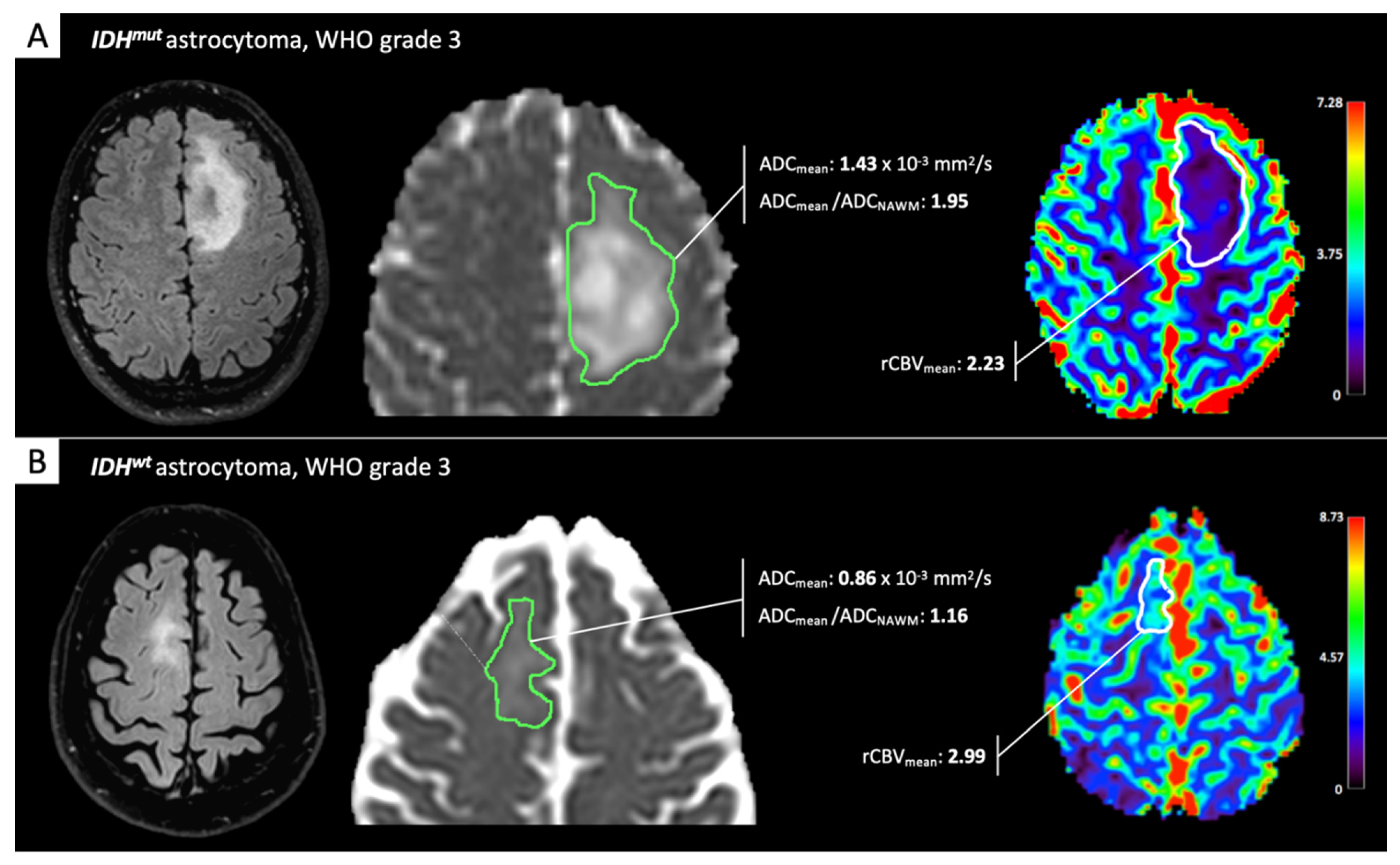Cancers 13 00424 g001
