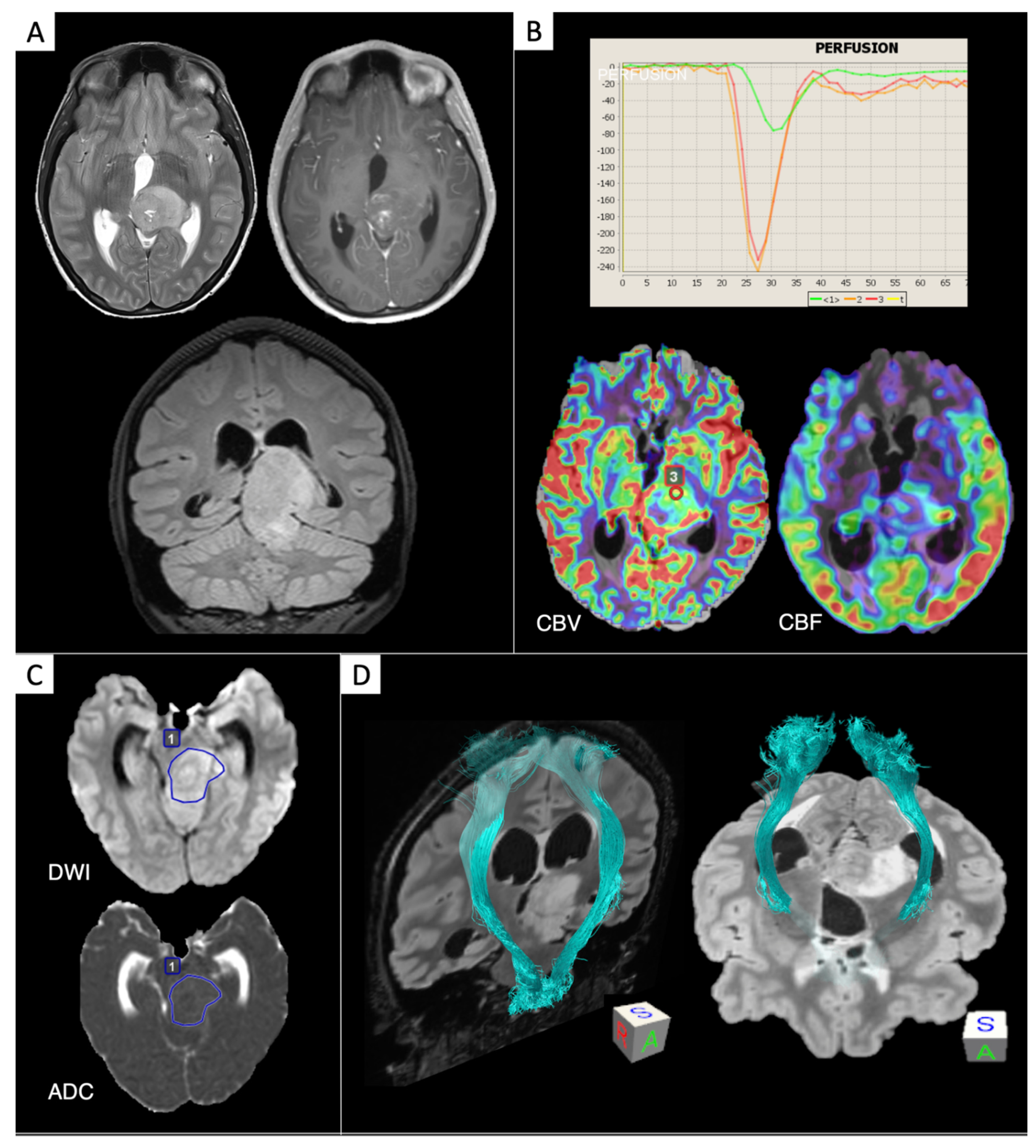Cancers 13 00424 g003