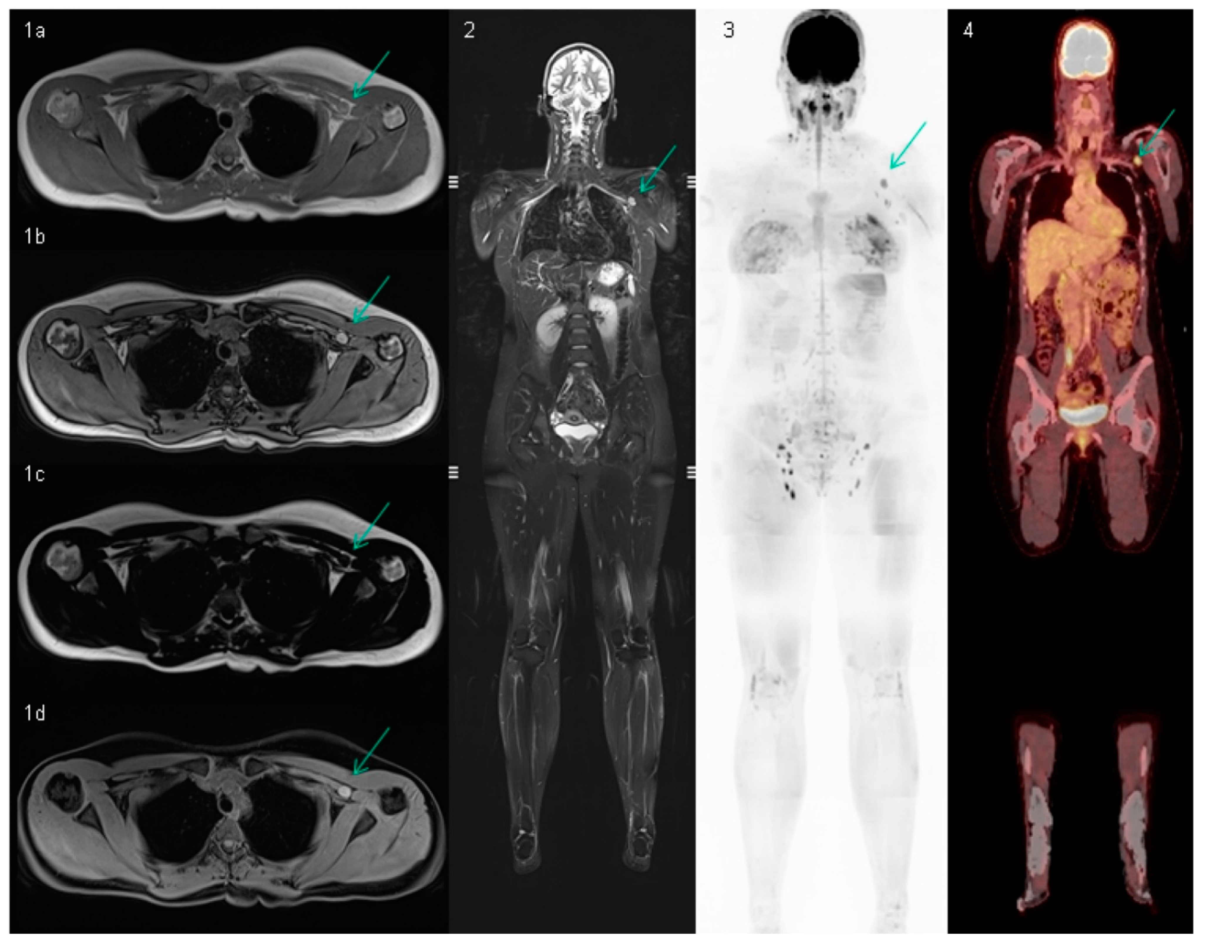 Cancers 13 00442 g003