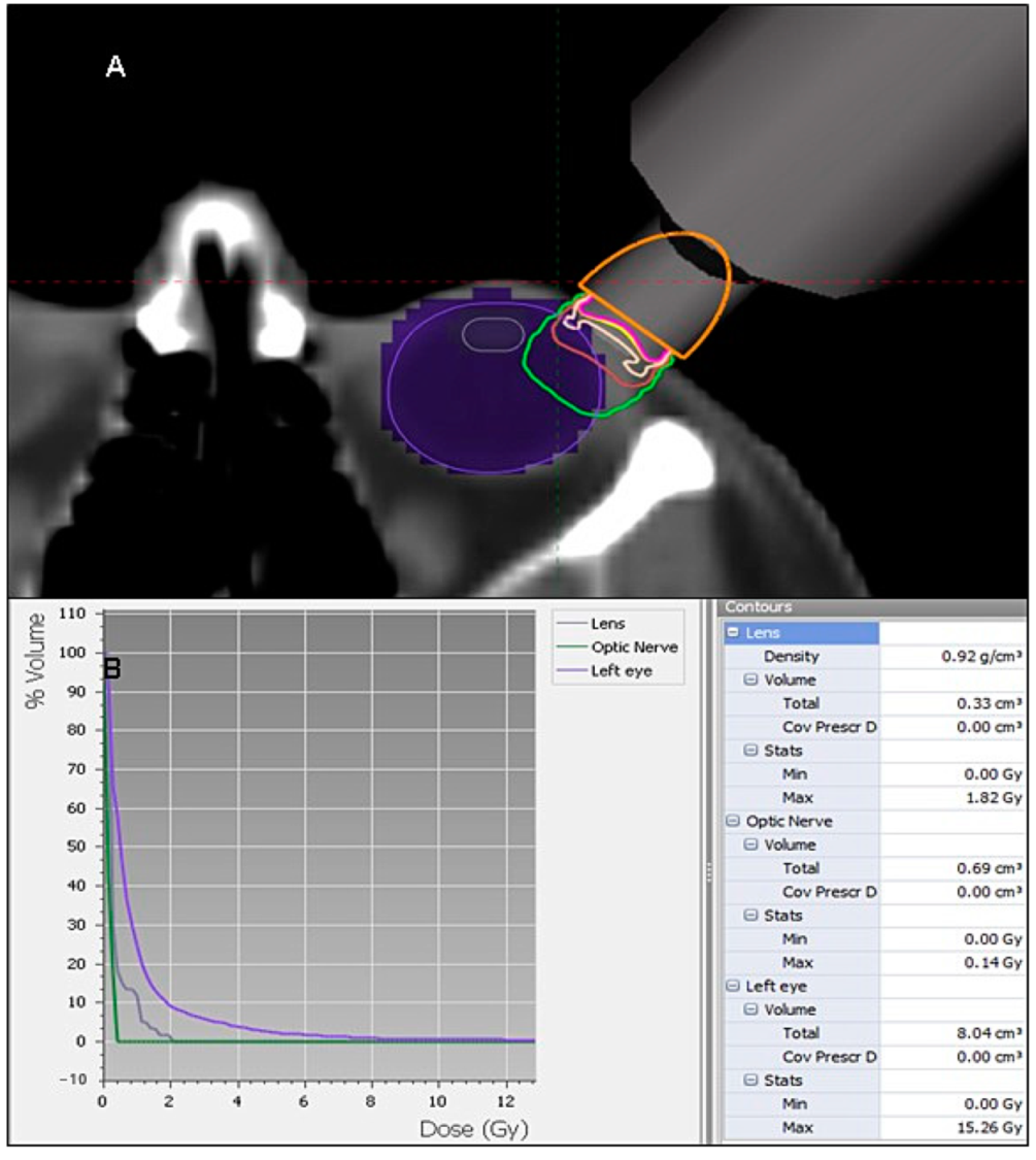 Cancers 13 00454 g002 Cancers 13 00454 g002