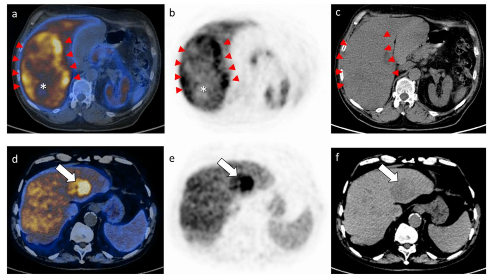 Cancers 13 00472 g001