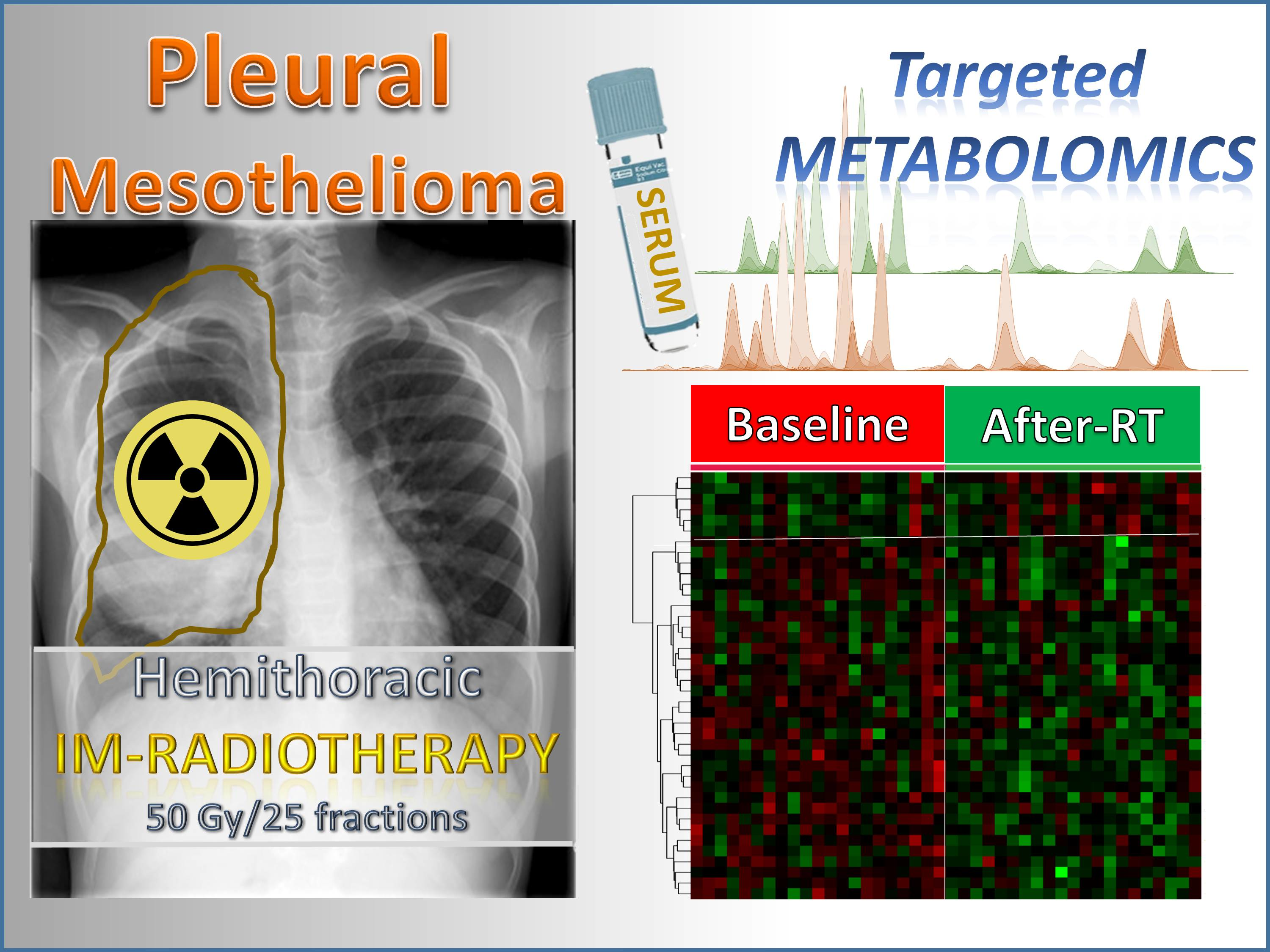 what is grade 4 mesothelioma