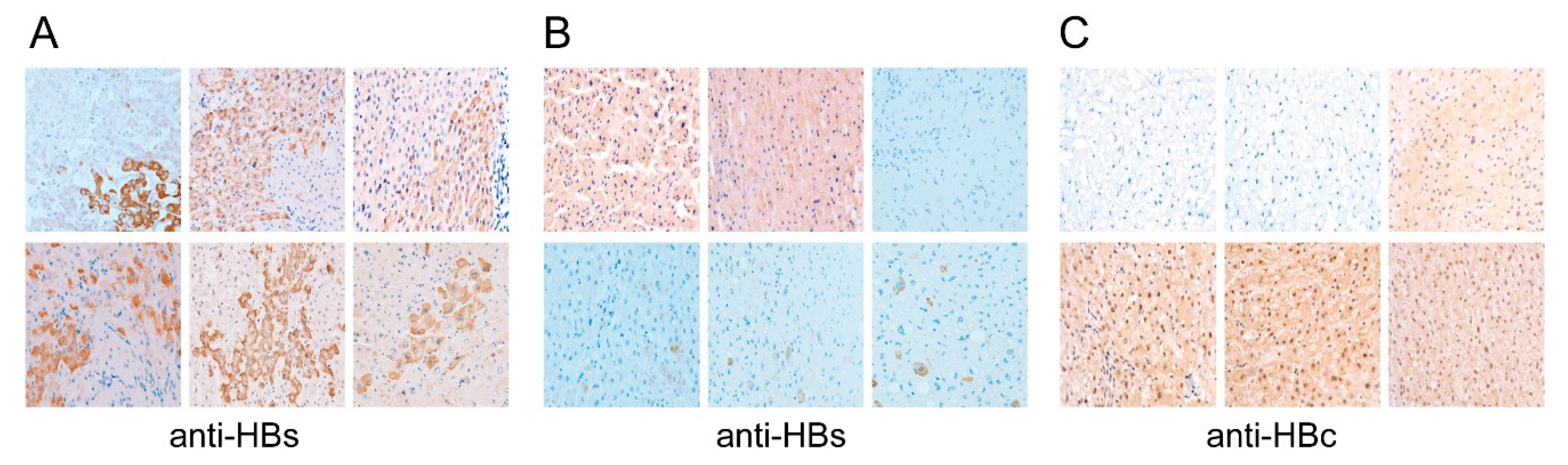 Cancers 13 00538 g003 Cancers 13 00538 g003