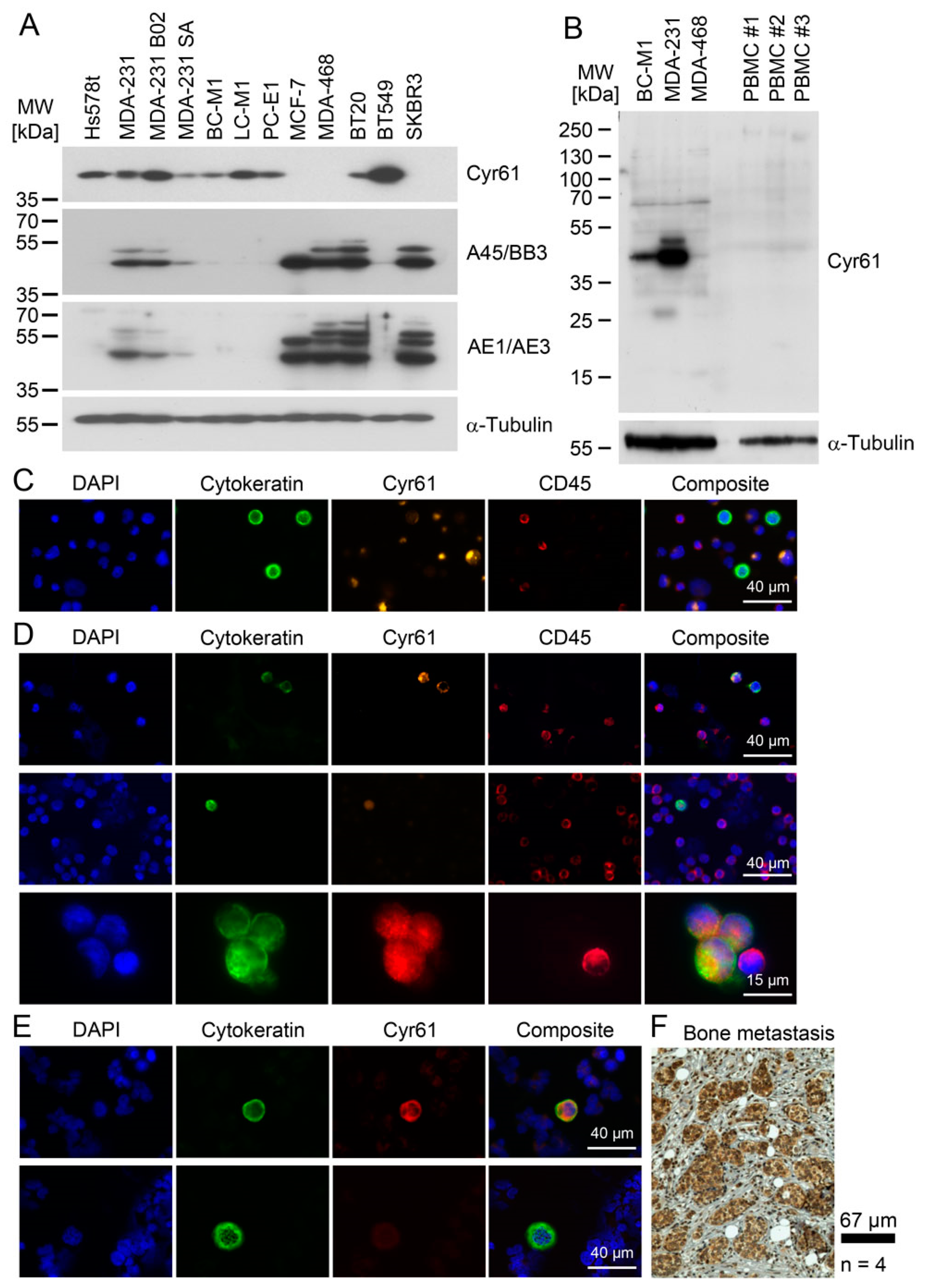 Cancers 13 00563 g005