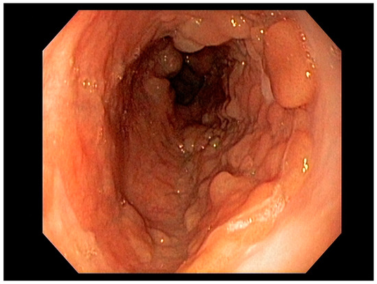 Cancers 13 00582 g001 550