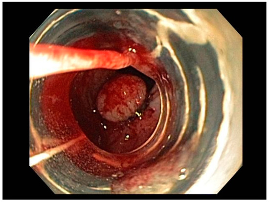 Cancers 13 00582 g005 550