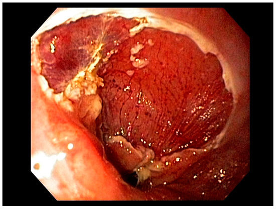 Cancers 13 00582 g006 550