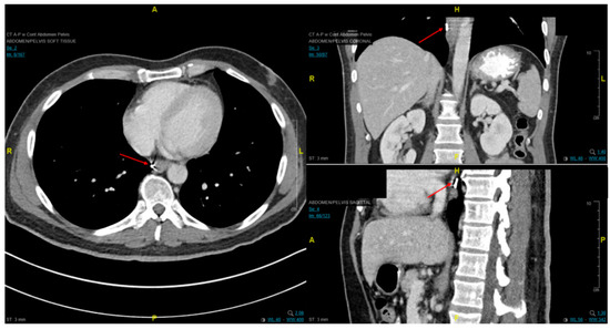 Cancers 13 00582 g007 550