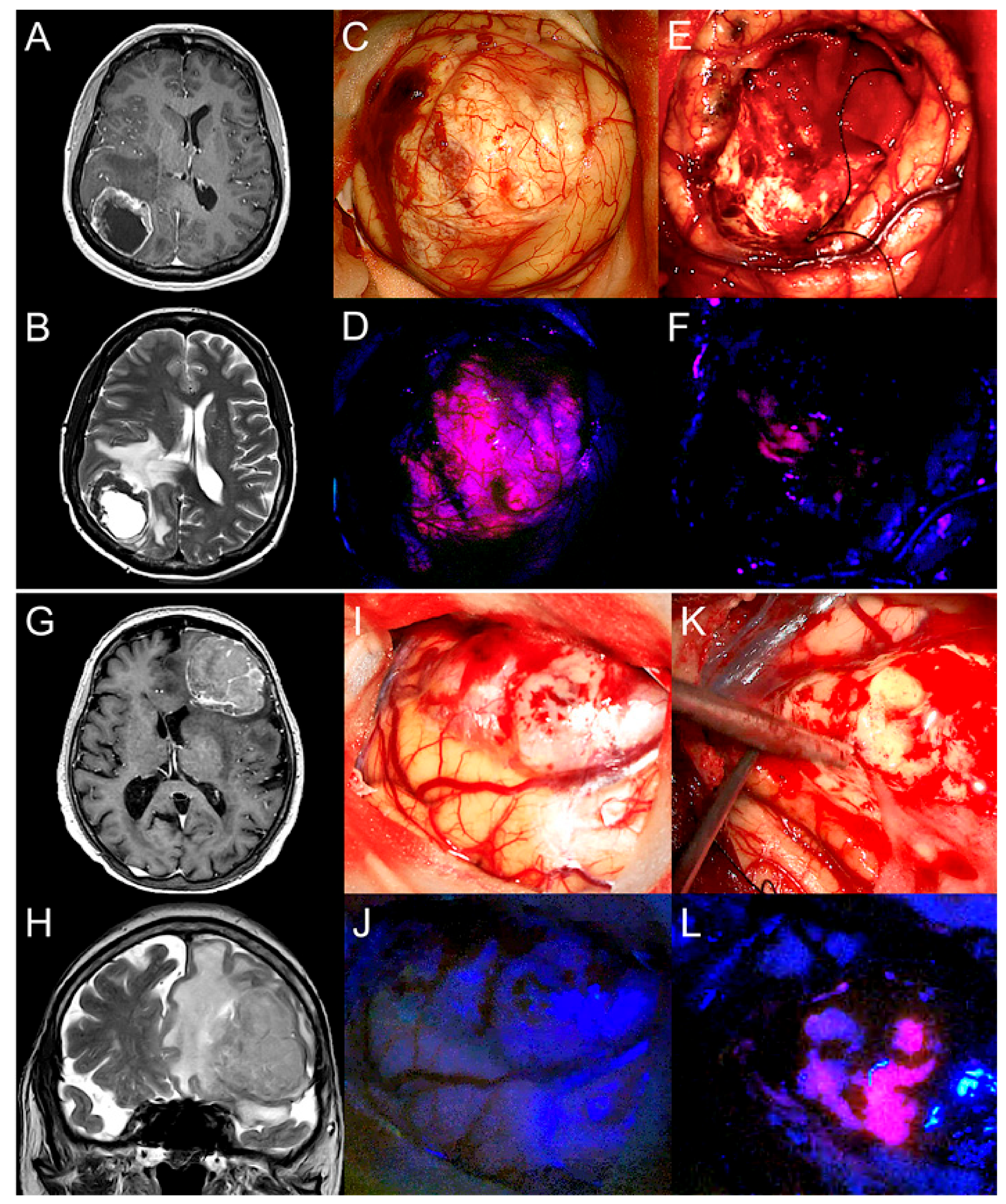 Cancers 13 00603 g002 Cancers 13 00603 g002