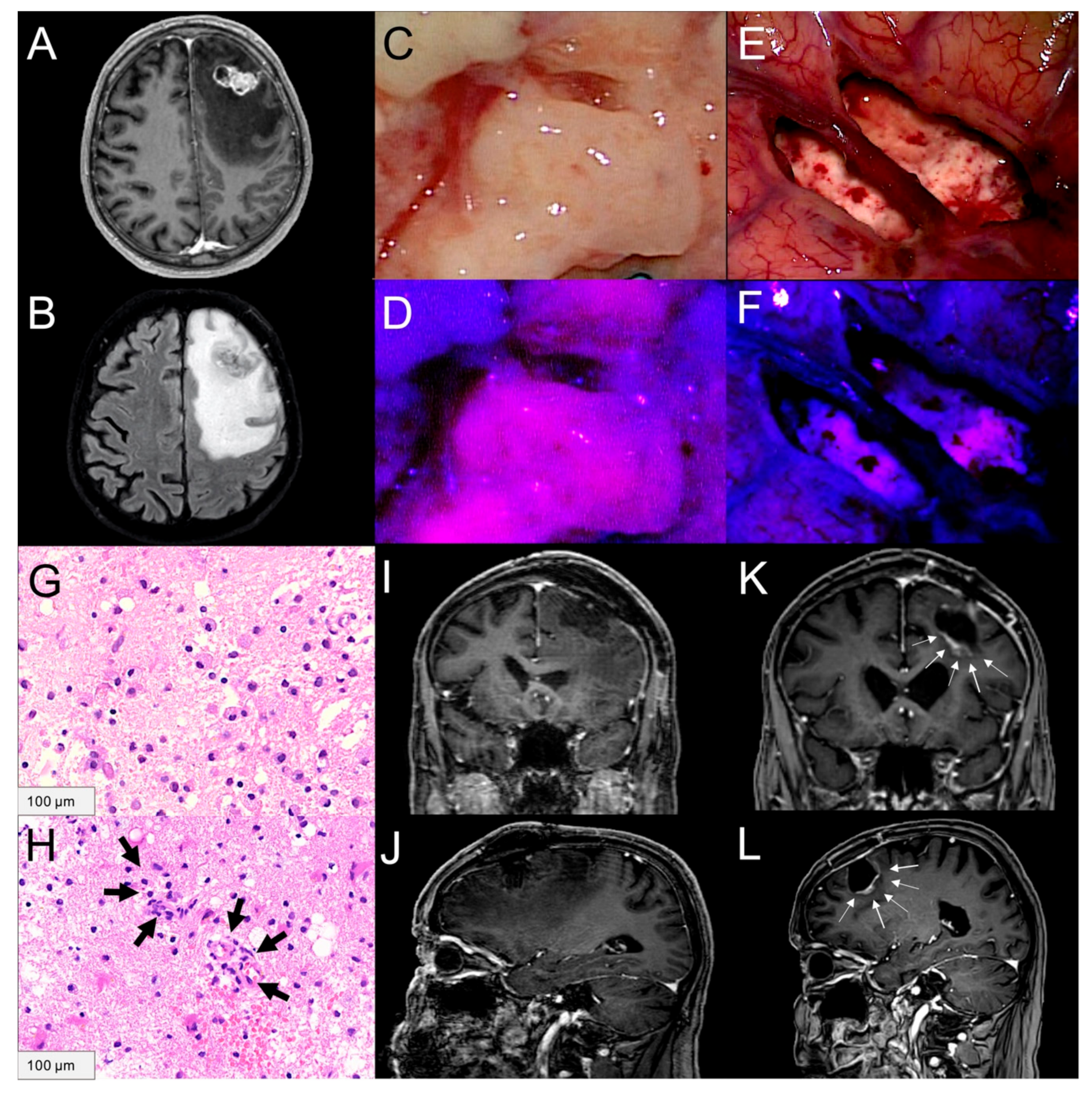 Cancers 13 00603 g003 Cancers 13 00603 g003