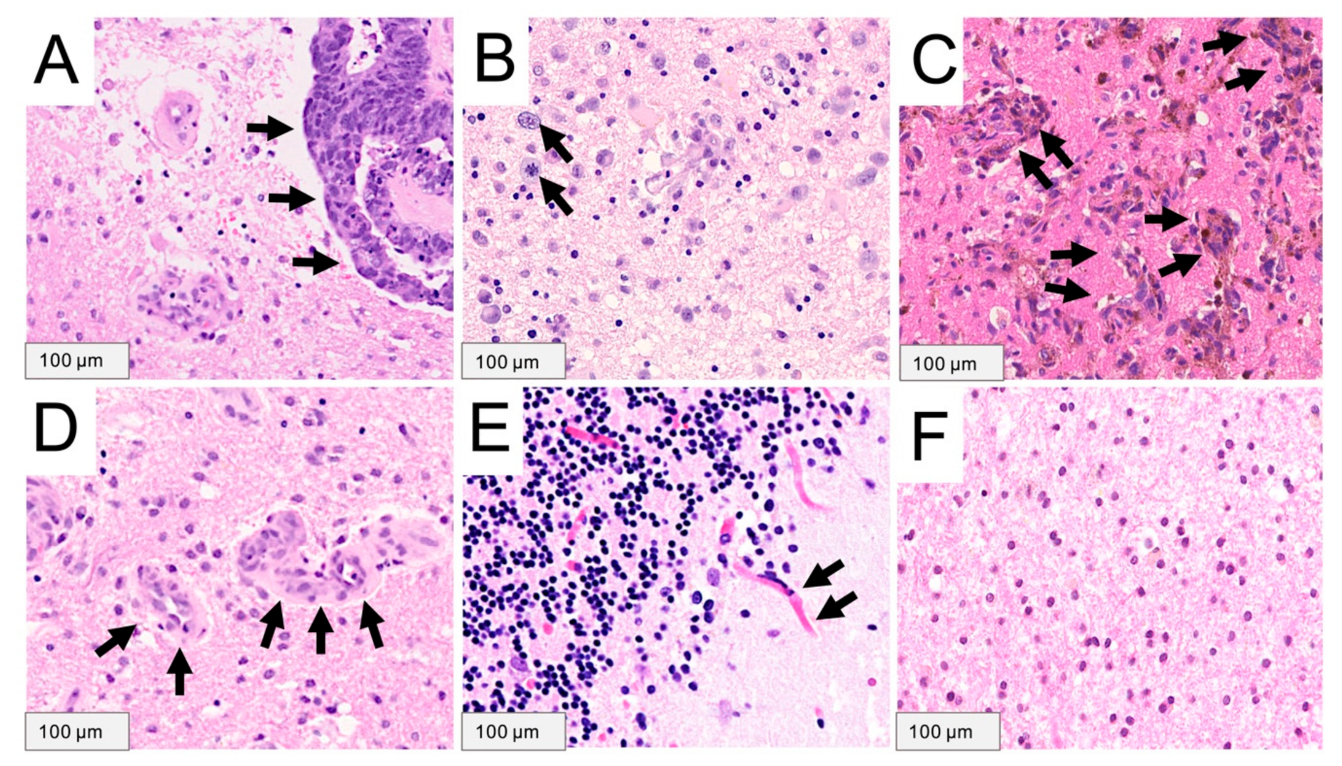 Cancers 13 00603 g004 Cancers 13 00603 g004