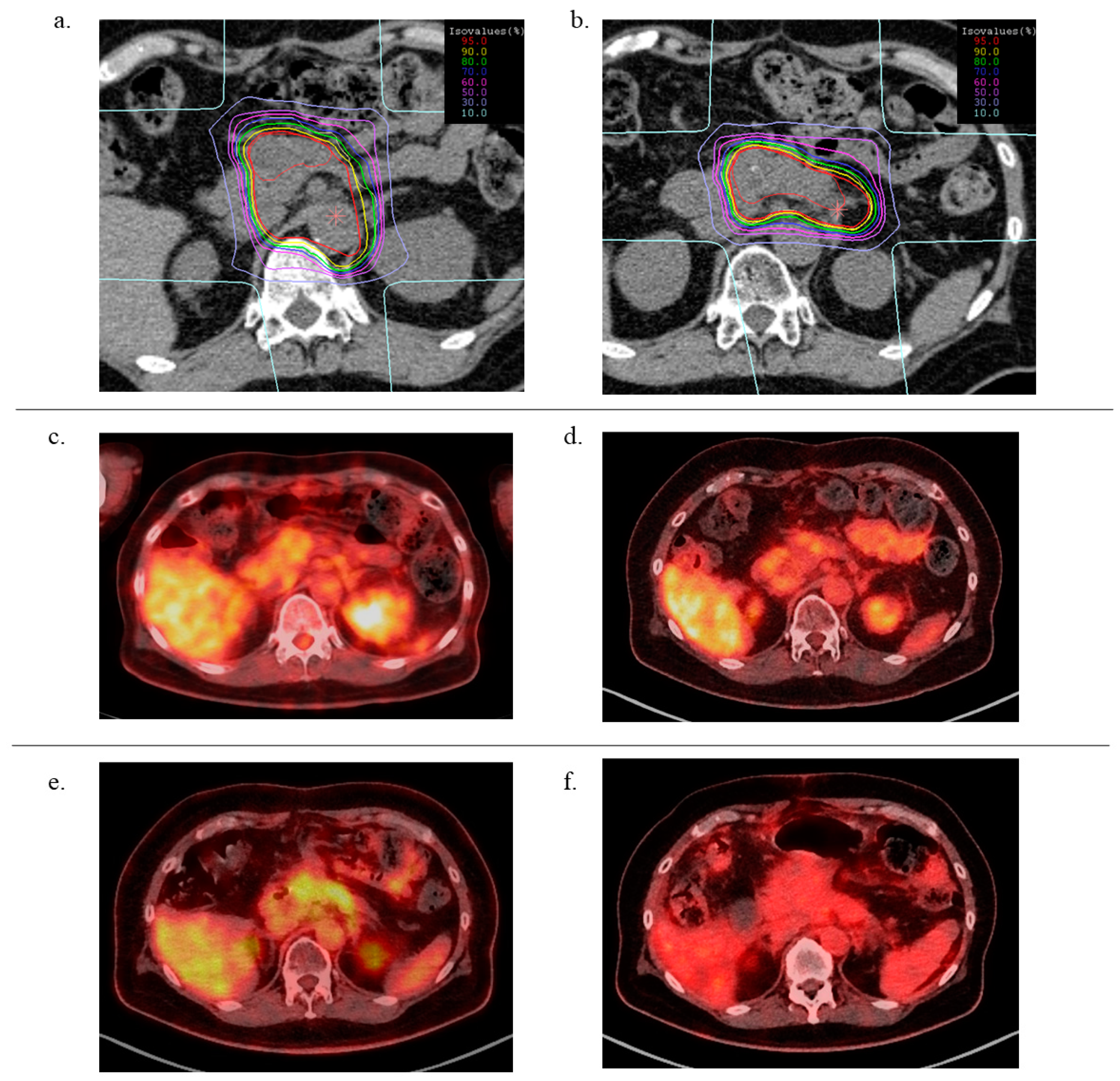 Cancers 13 00665 g001 Cancers 13 00665 g001