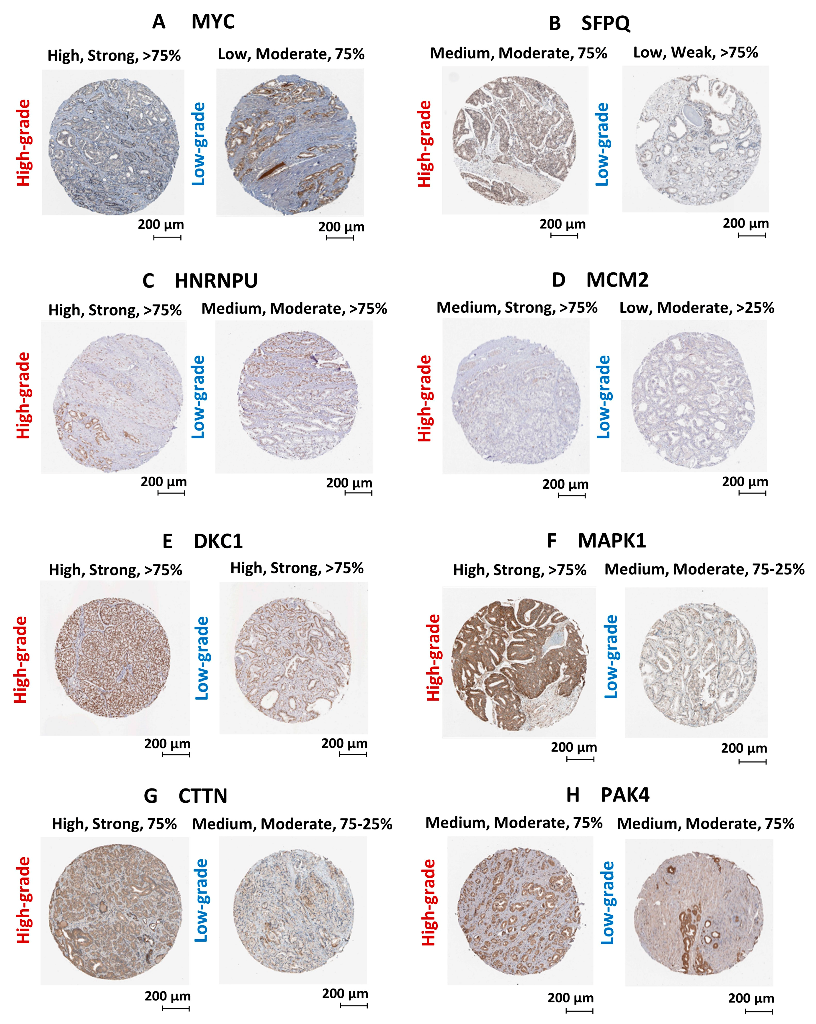 Cancers 13 00715 g009 Cancers 13 00715 g009