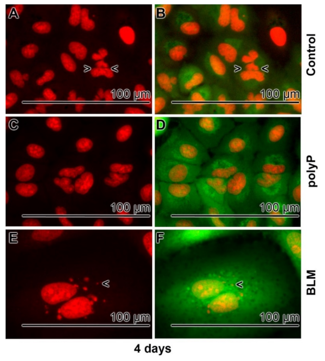 Cancers 13 00750 g005