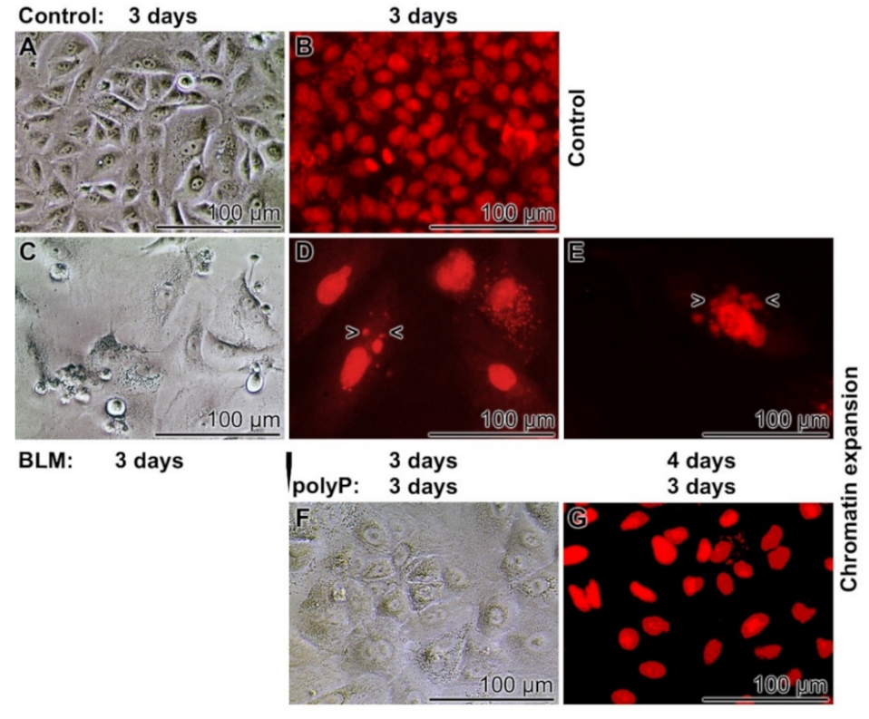 Cancers 13 00750 g007