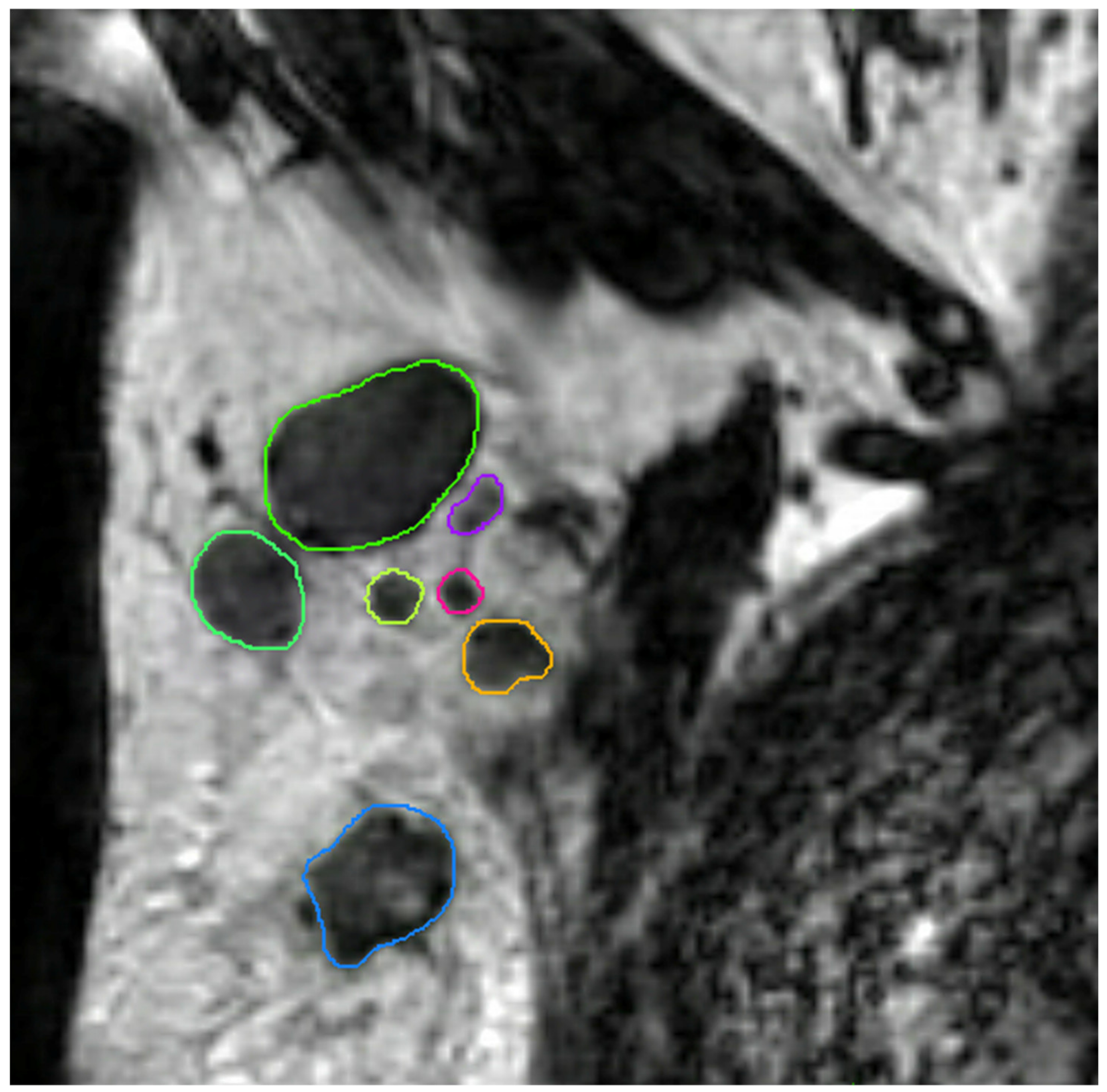 Cancers 13 00757 g004 Cancers 13 00757 g004