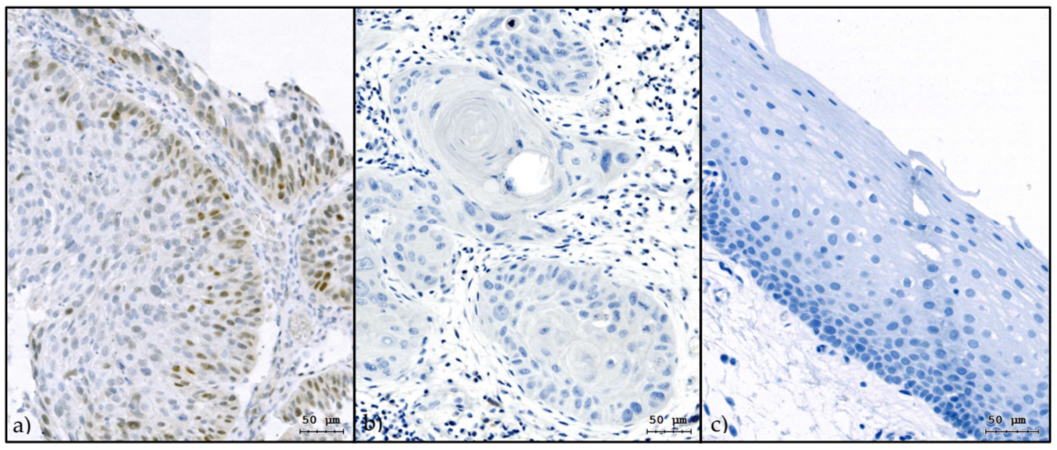 Cancers 13 00772 g001 Cancers 13 00772 g001