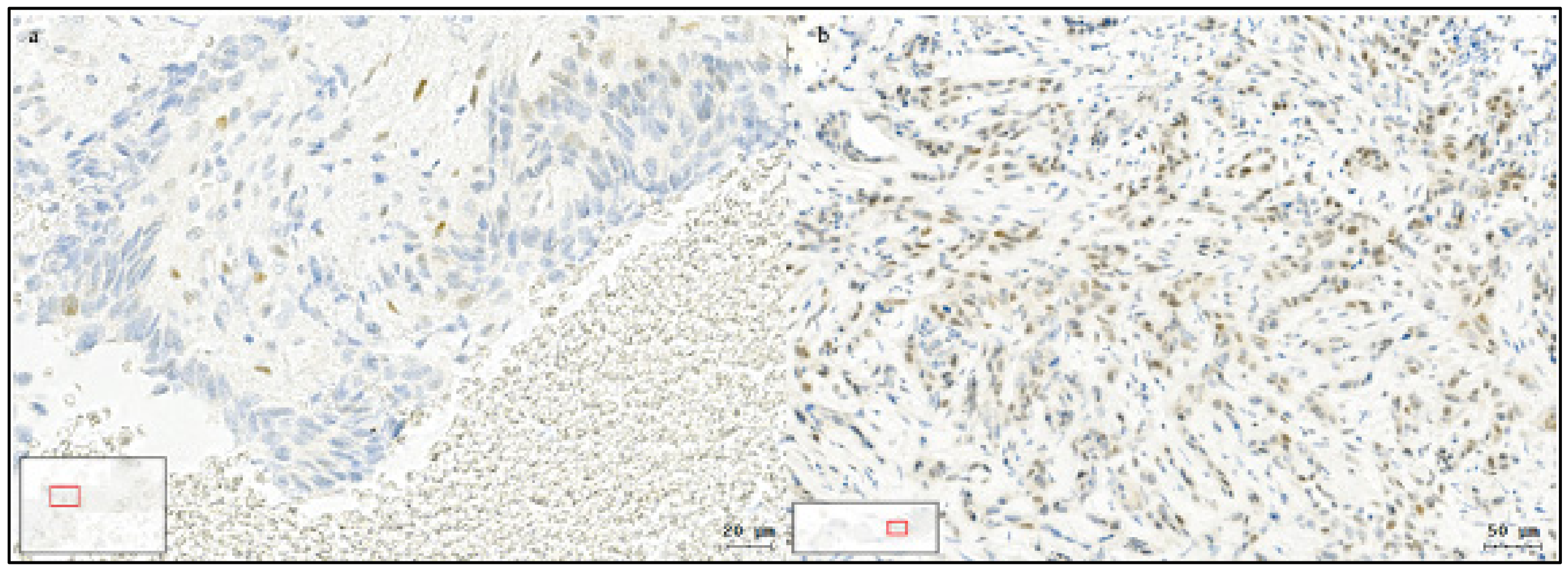 Cancers 13 00772 g003 Cancers 13 00772 g003