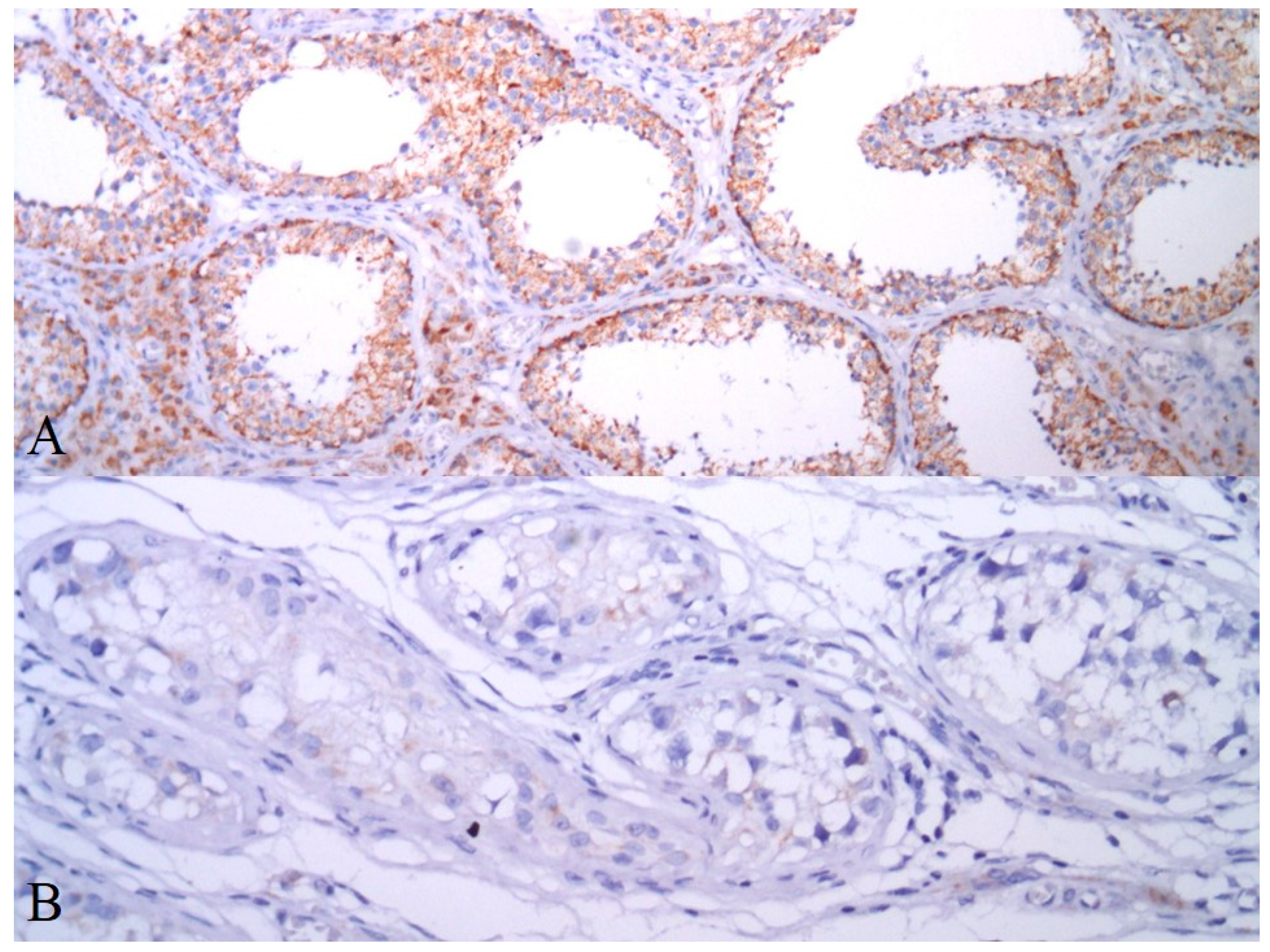 Cancers 13 00776 g004