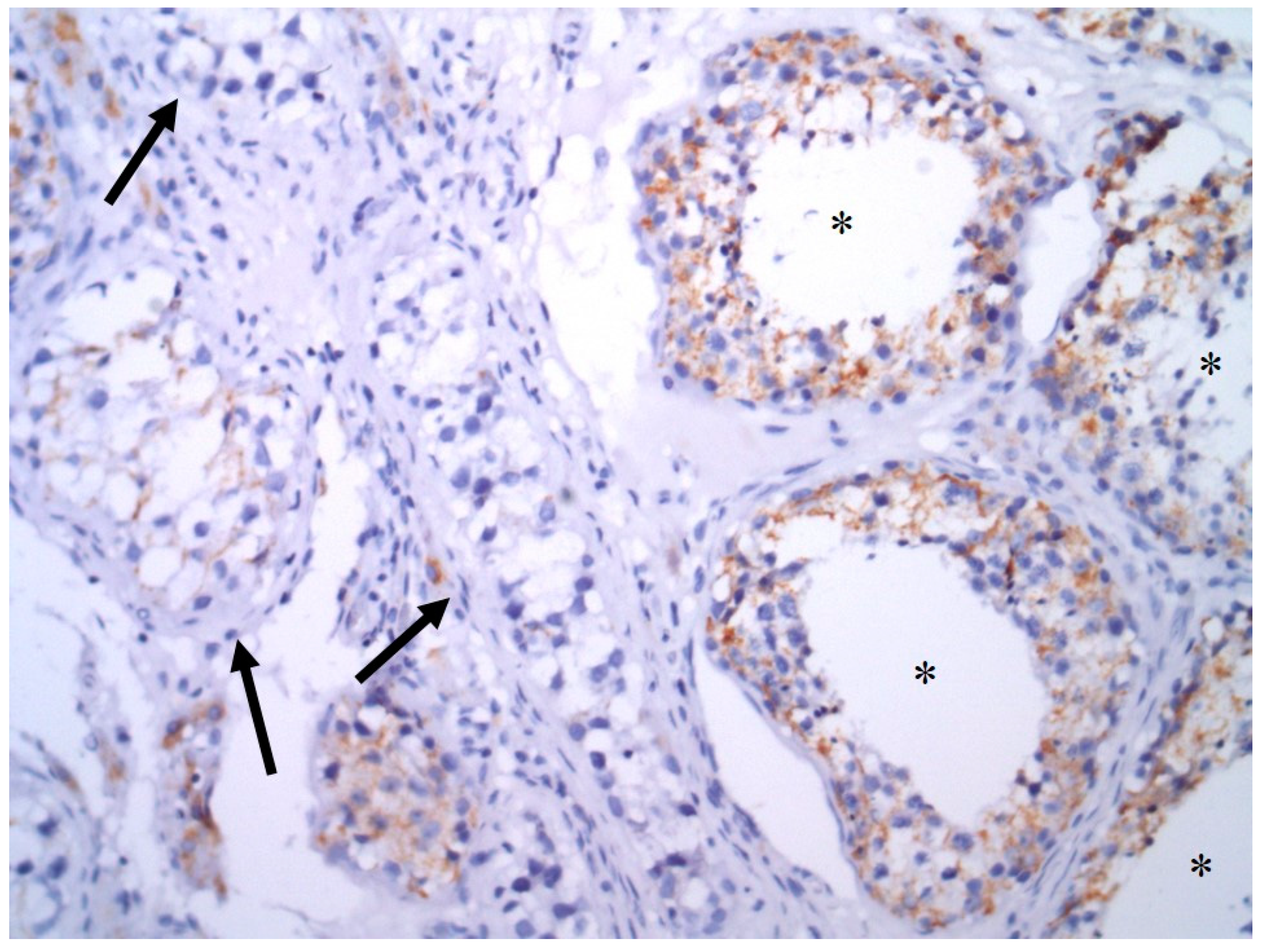 Cancers 13 00776 g005