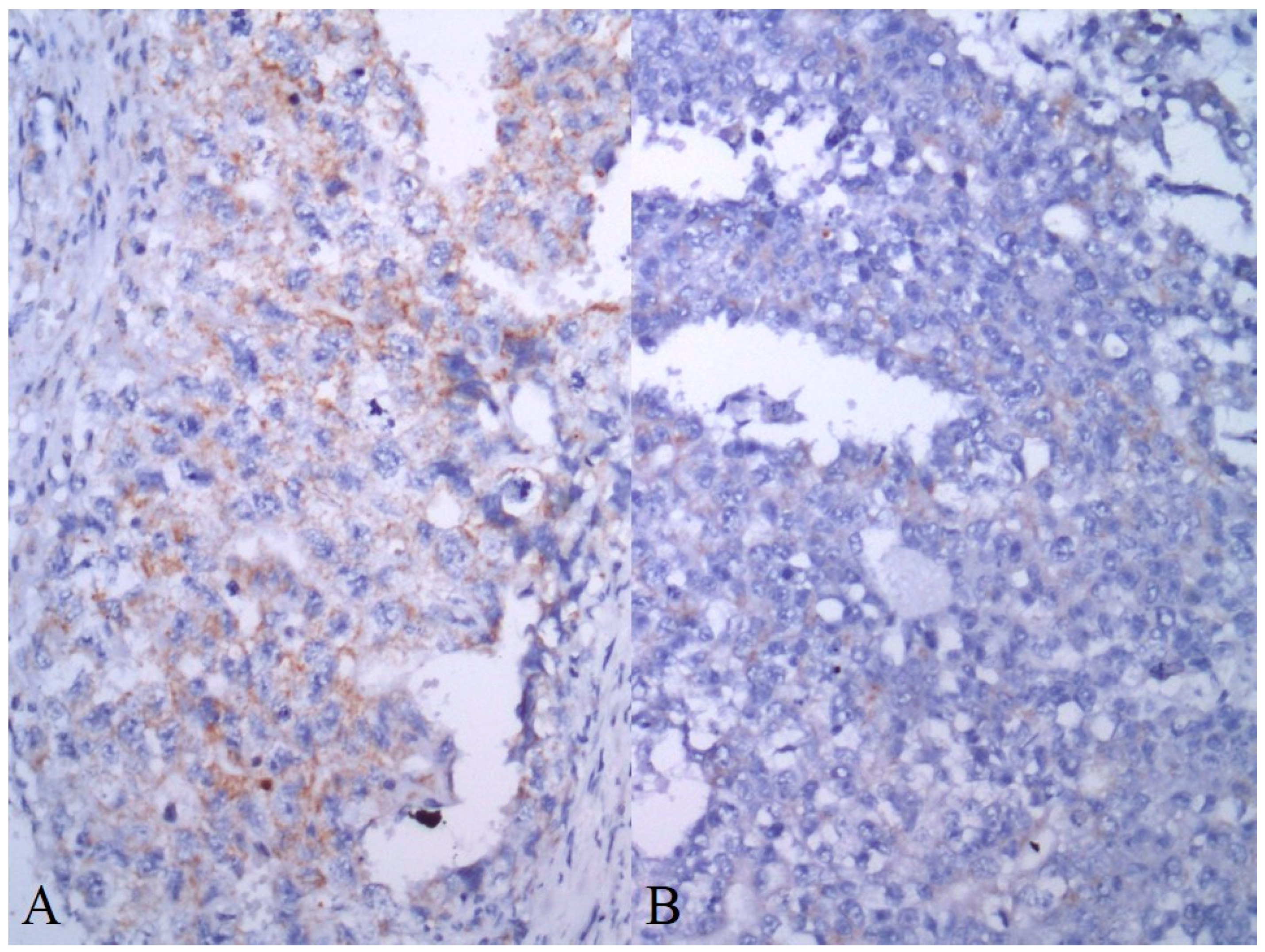 Cancers 13 00776 g006