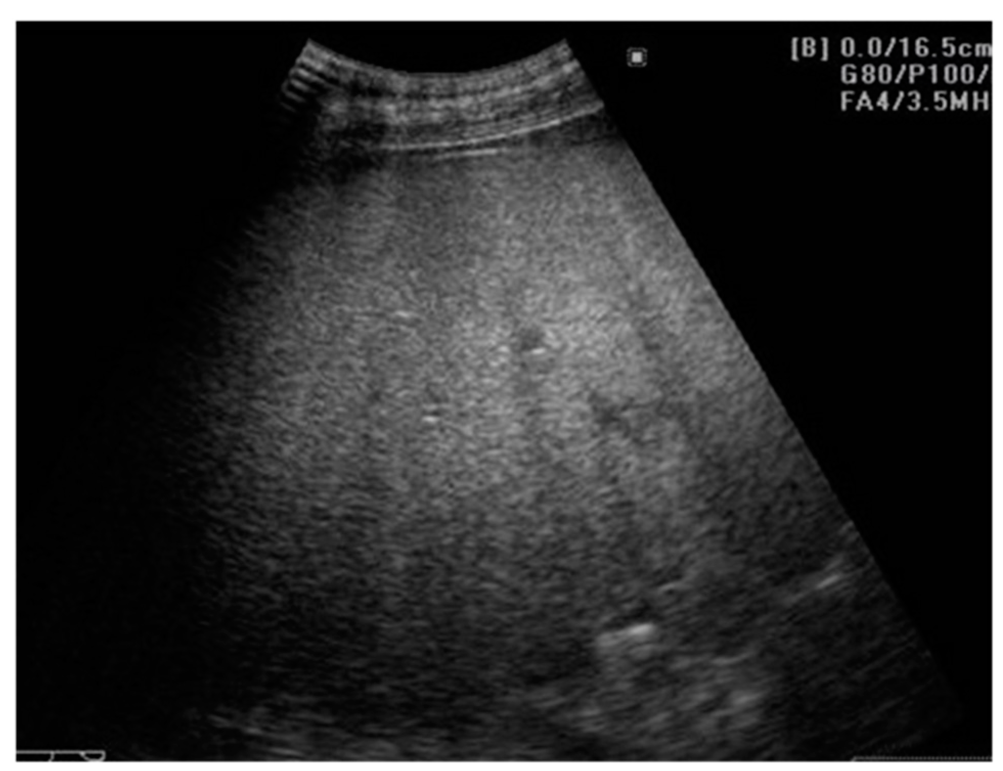 Cancers 13 00790 g001