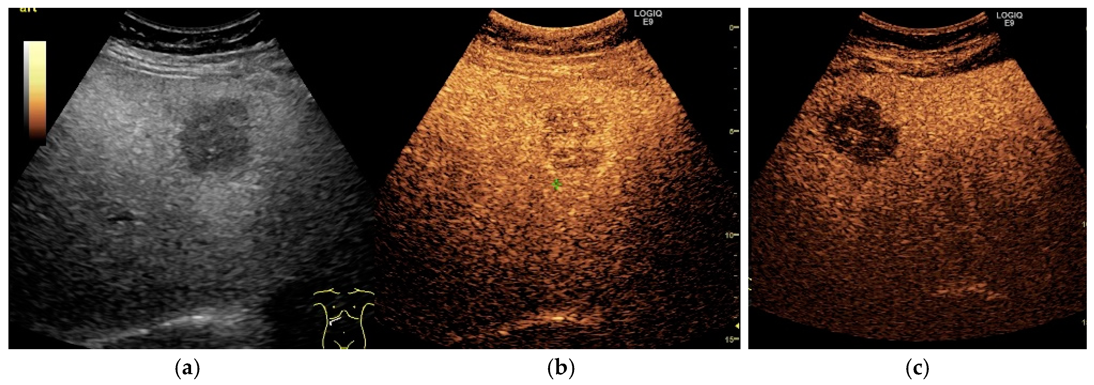 Cancers 13 00790 g003