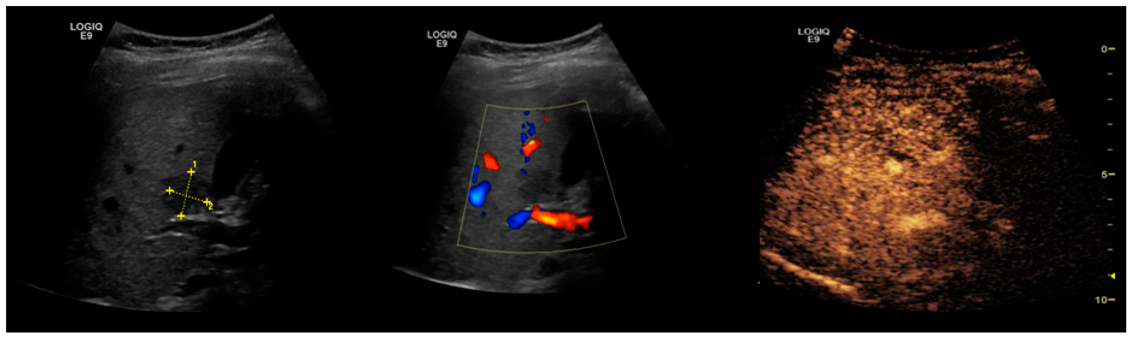 Cancers 13 00790 g005