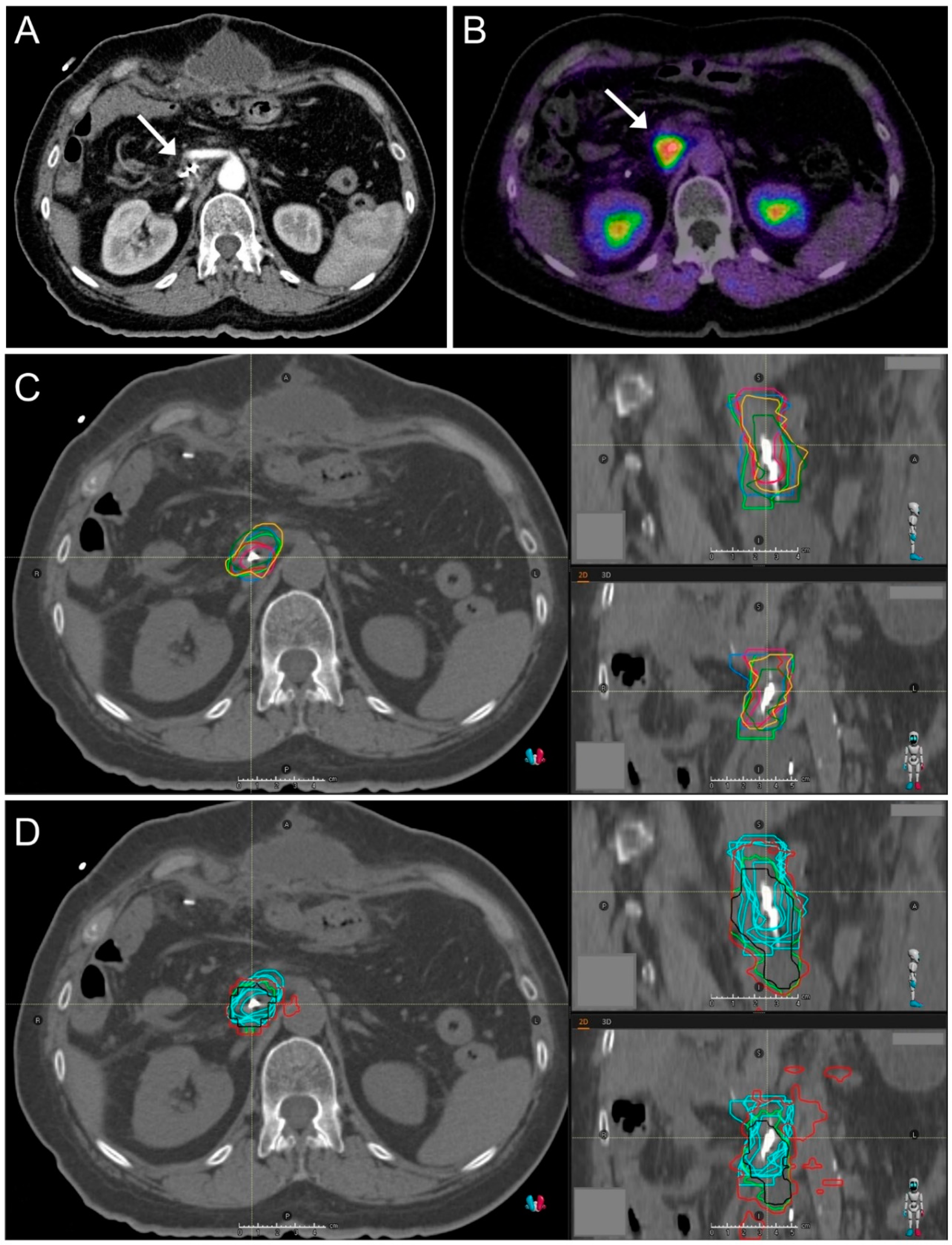 Cancers 13 00796 g003 Cancers 13 00796 g003
