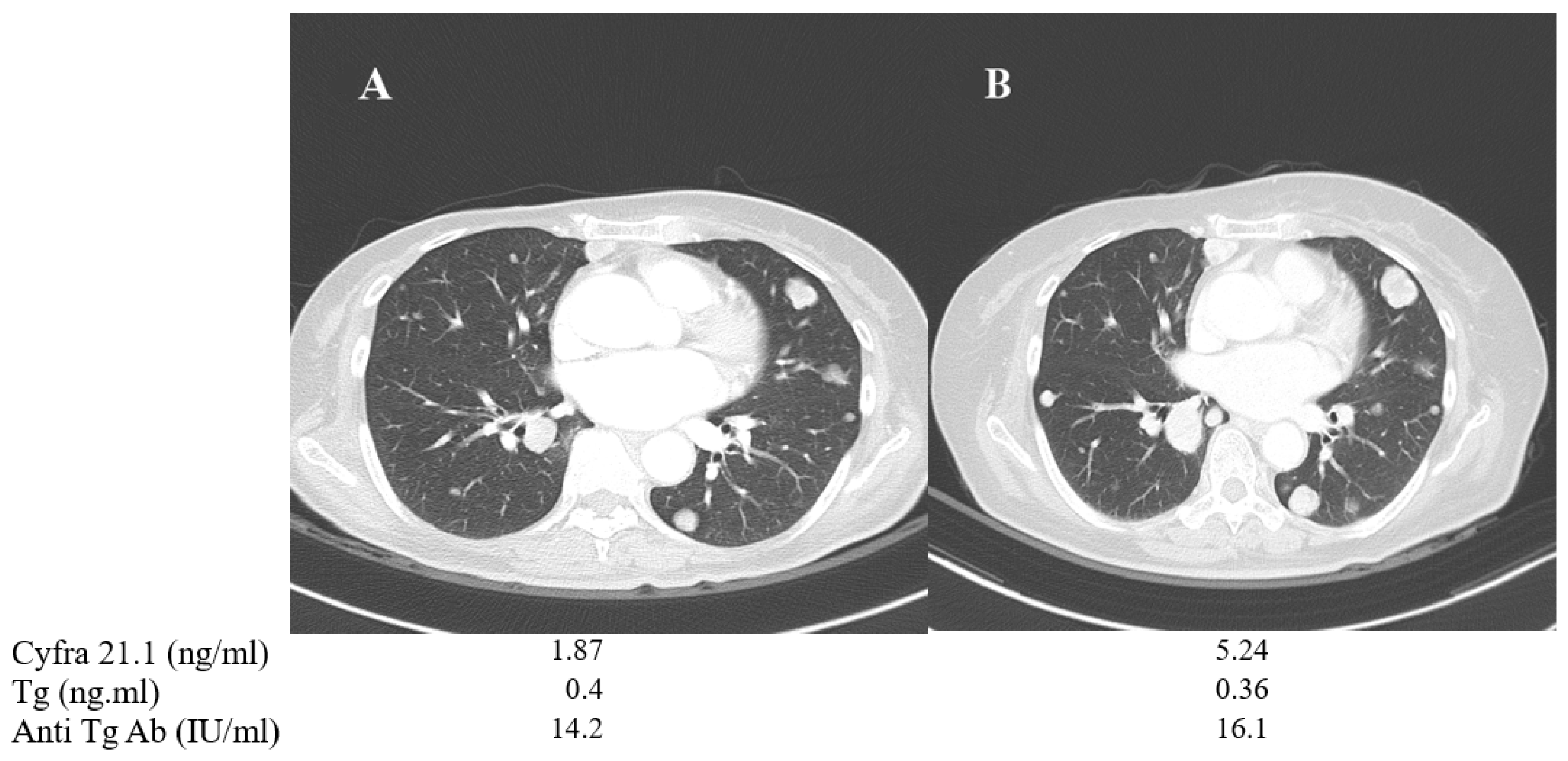 Cancers 13 00811 g004 Cancers 13 00811 g004
