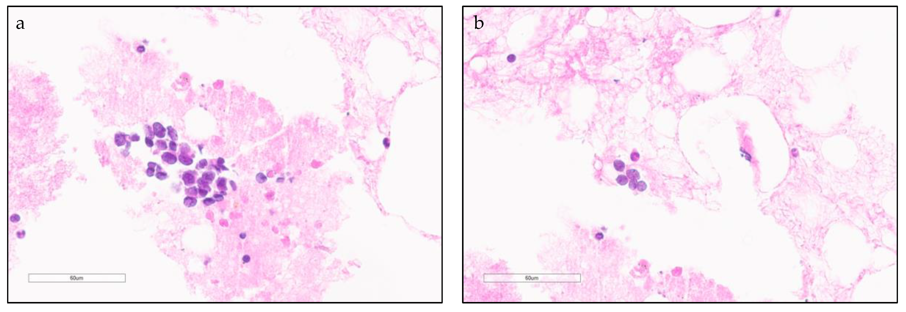 Cancers 13 00820 g001