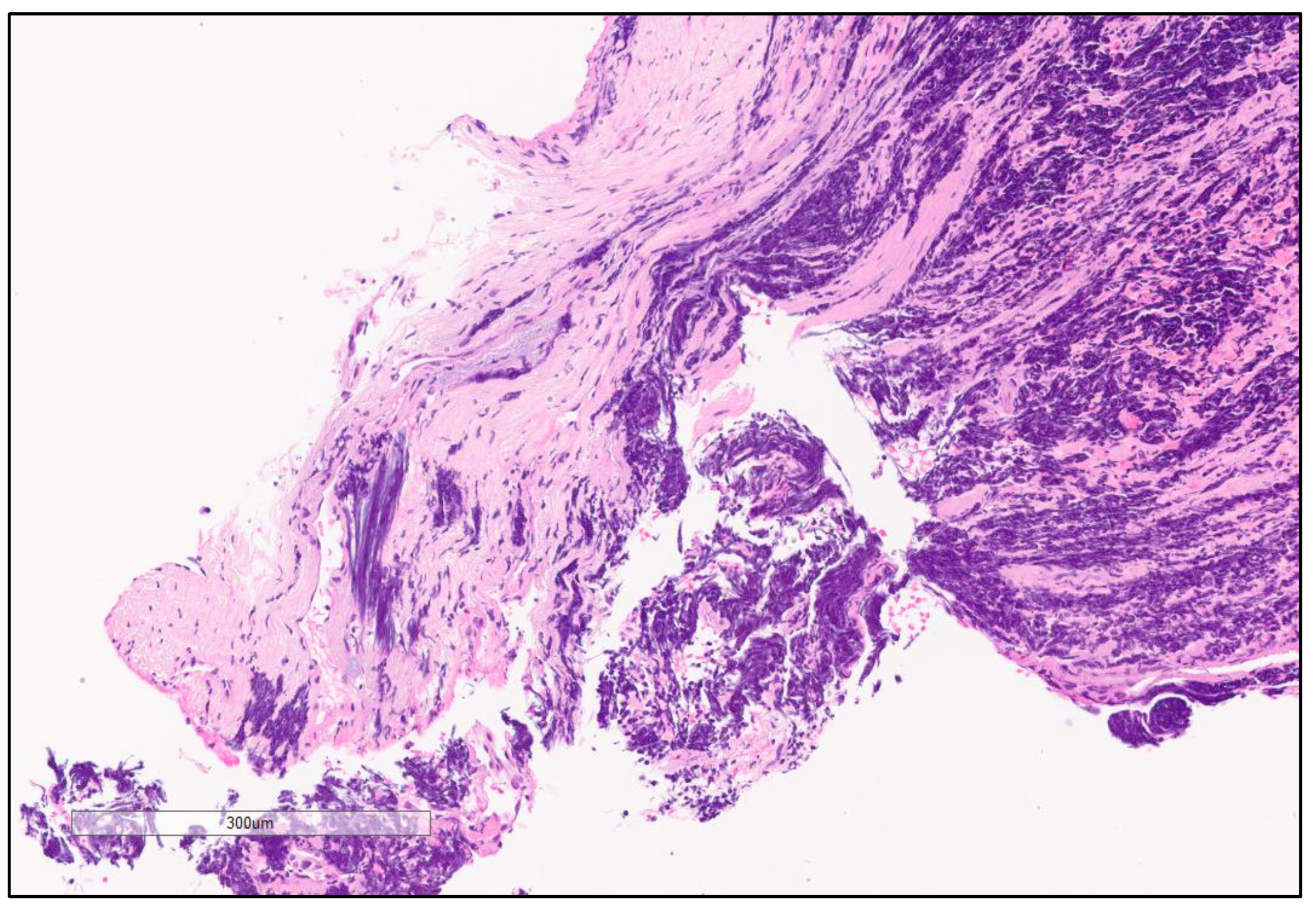 Cancers 13 00820 g003