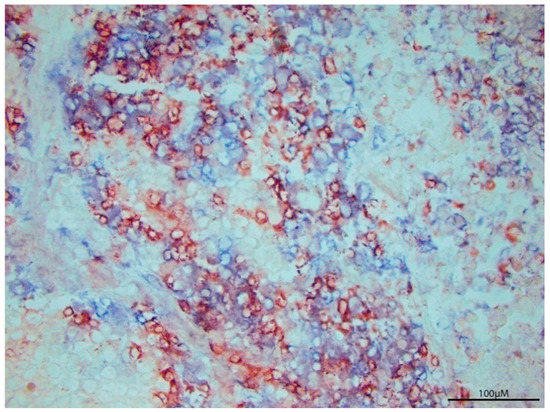 Cancers 13 00821 g001 550