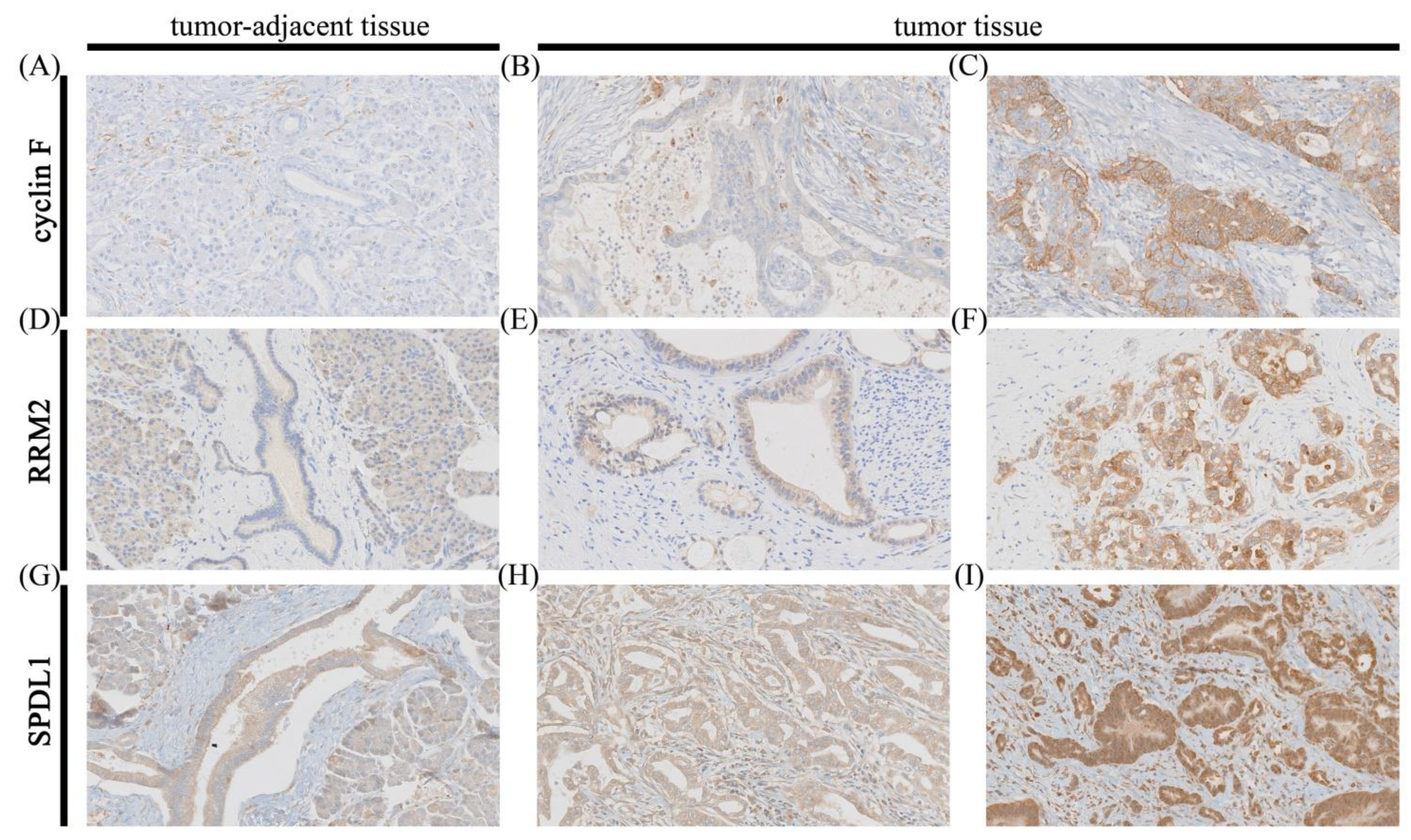 Cancers 13 00859 g001 Cancers 13 00859 g001