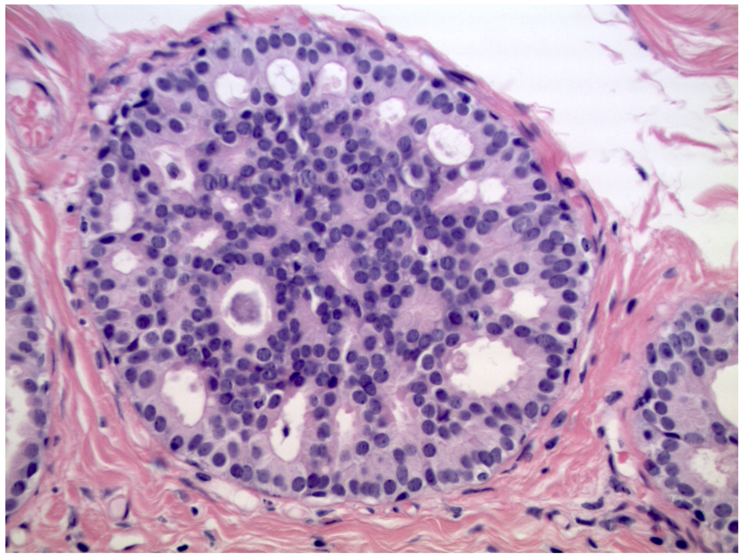 Cancers 13 00868 g002 Cancers 13 00868 g002