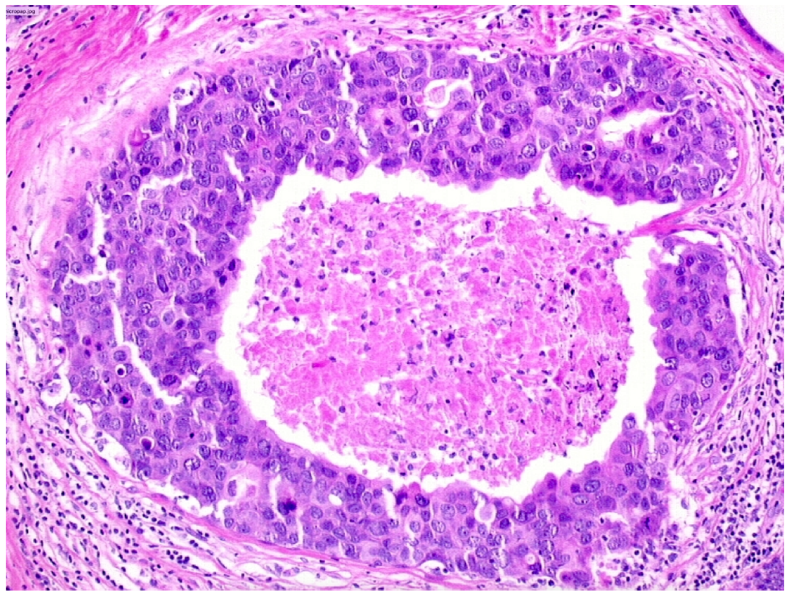 Cancers 13 00868 g004 Cancers 13 00868 g004