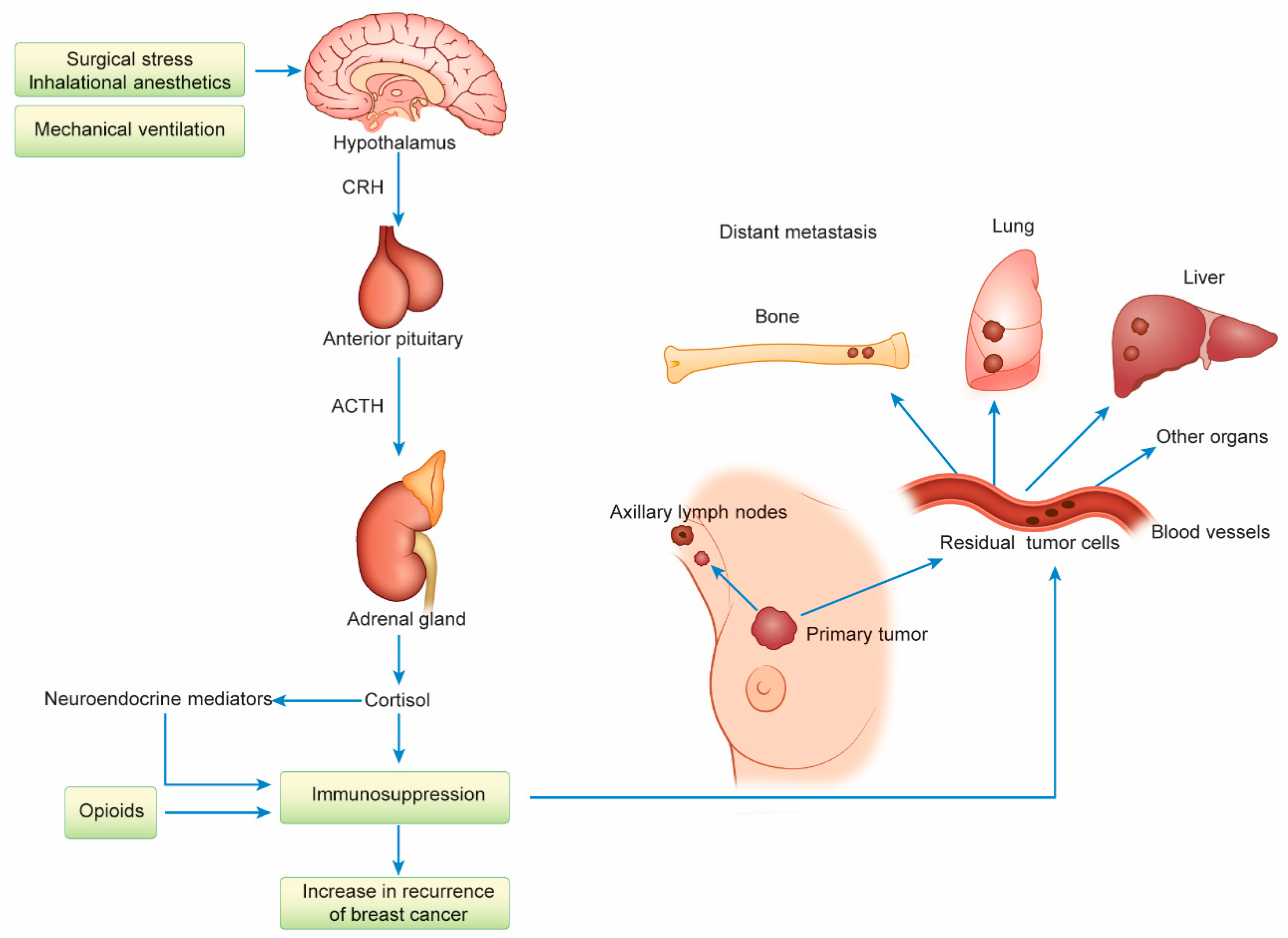 Cancers 13 00926 g004 Cancers 13 00926 g004