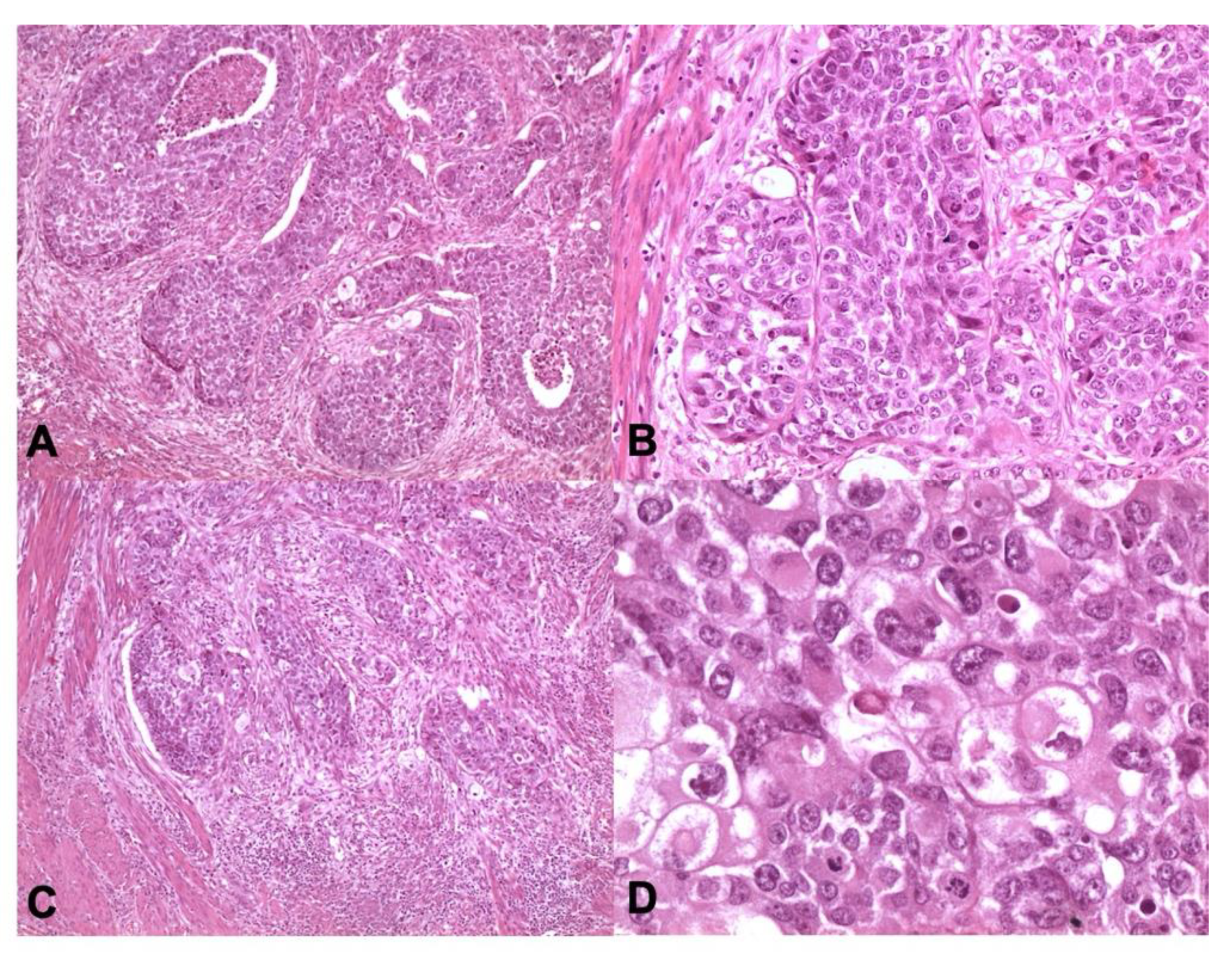 Cancers 13 00950 g004