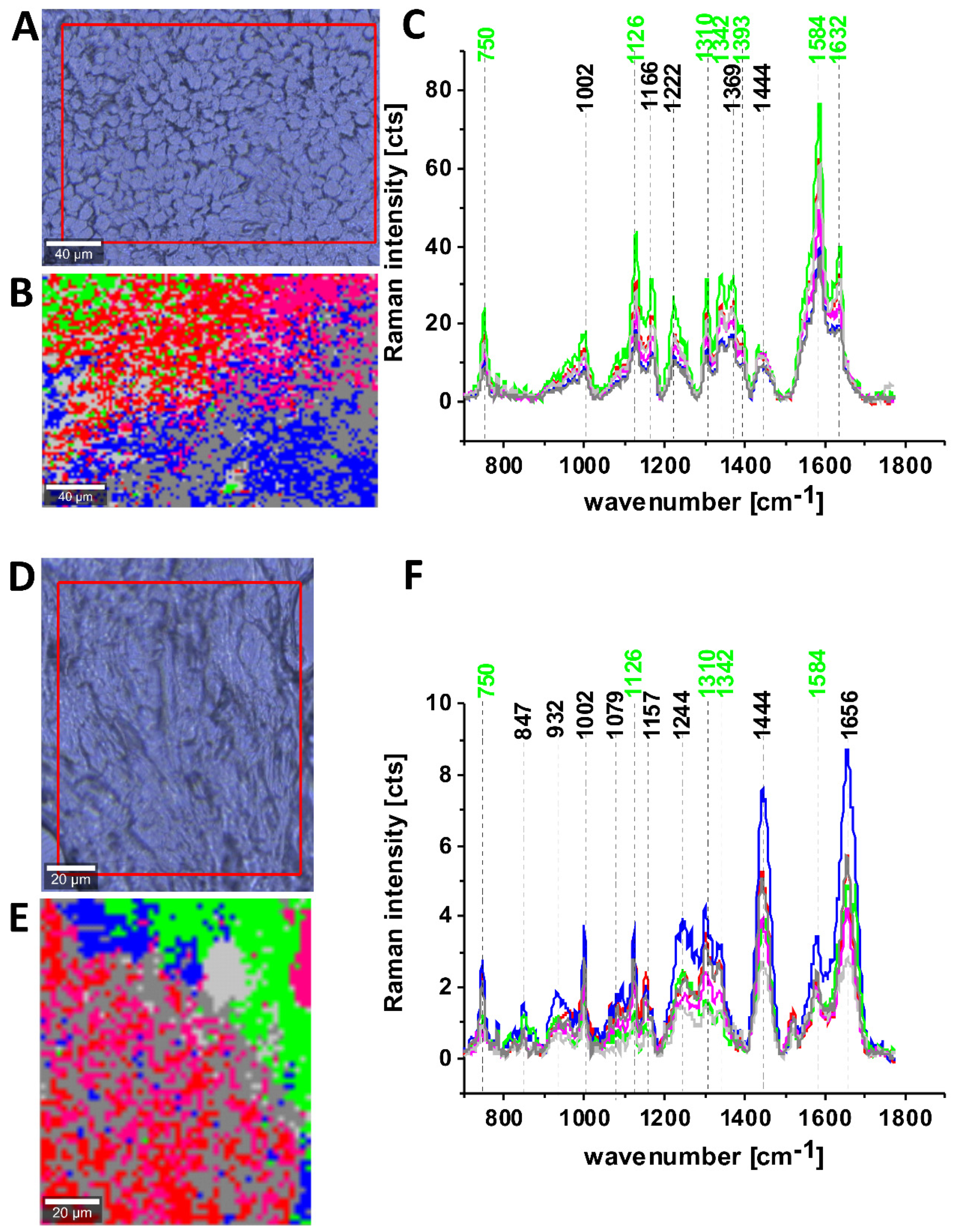 Cancers 13 00960 g009