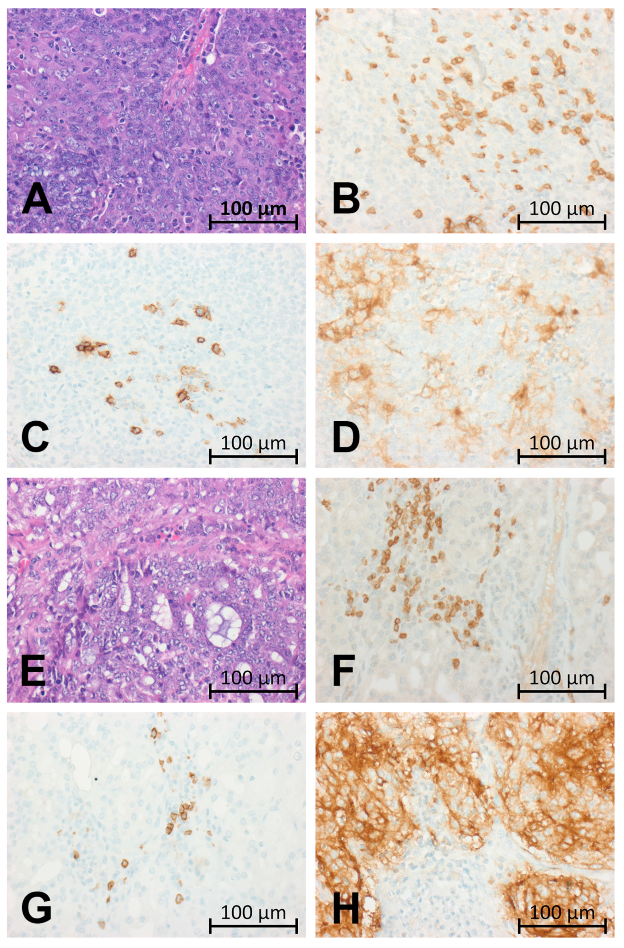 Cancers 13 00965 g001