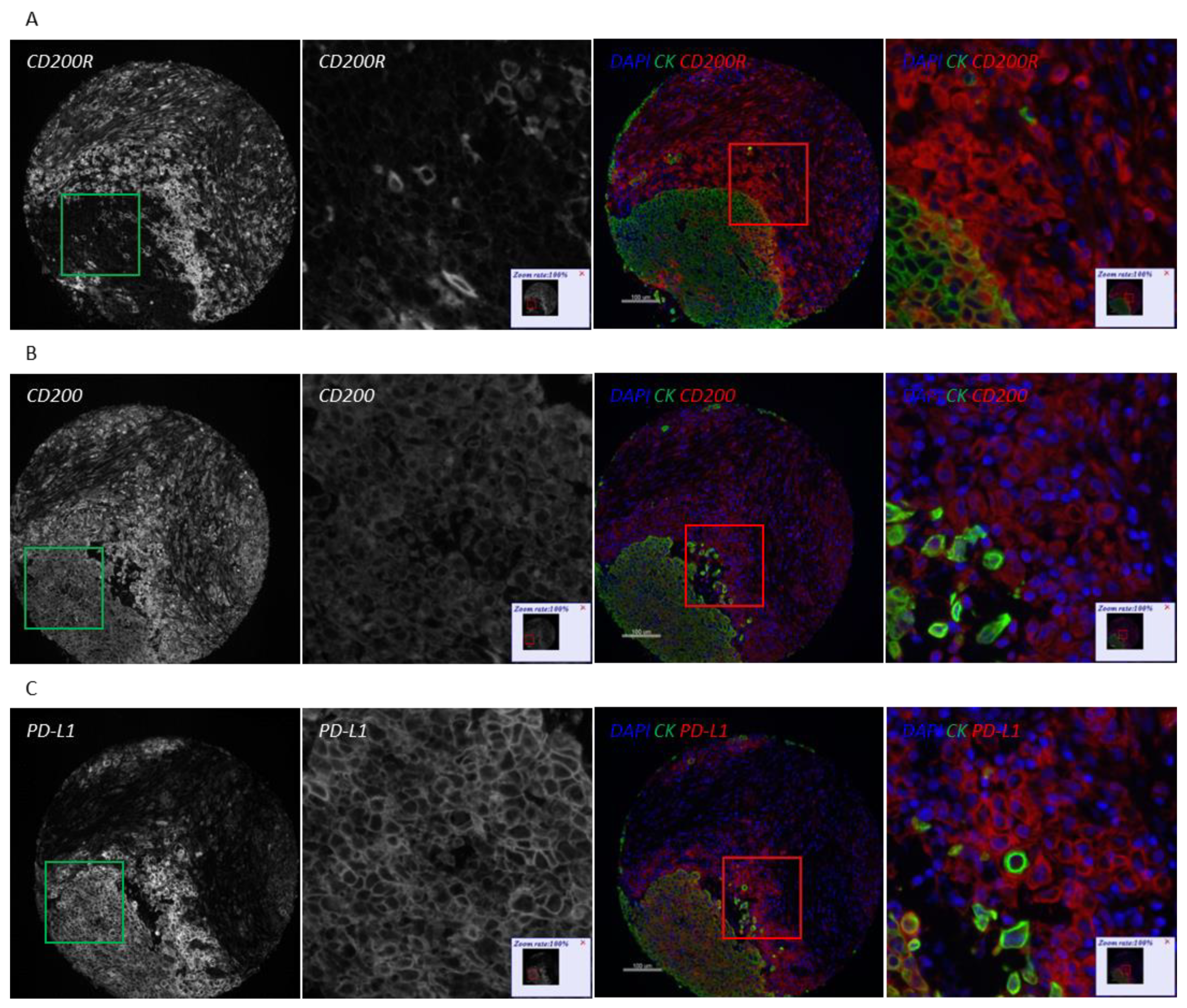 Cancers 13 01024 g004a