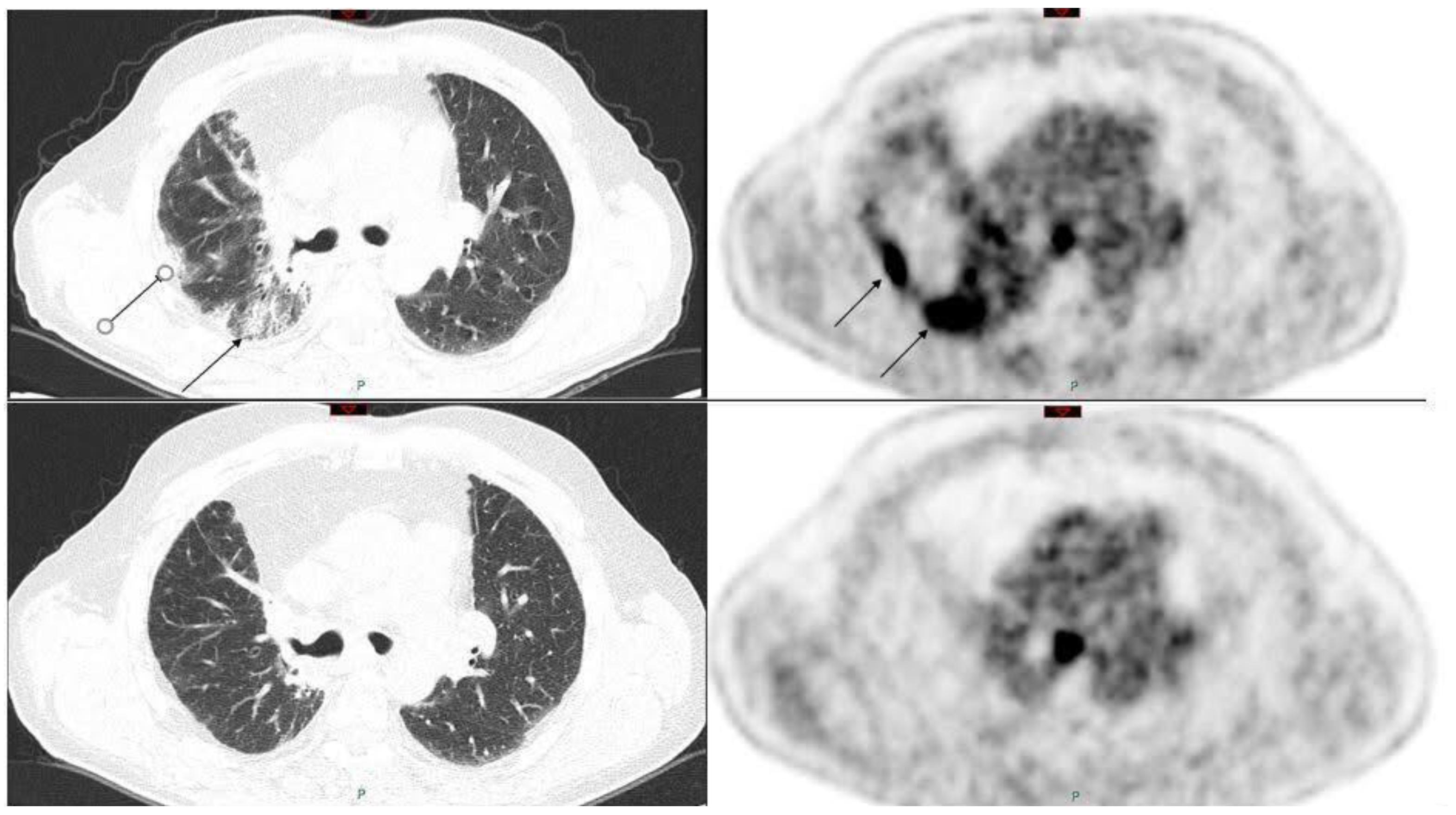 Cancers 13 01052 g002