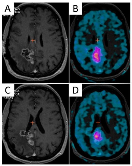 Cancers 13 01063 g003 550