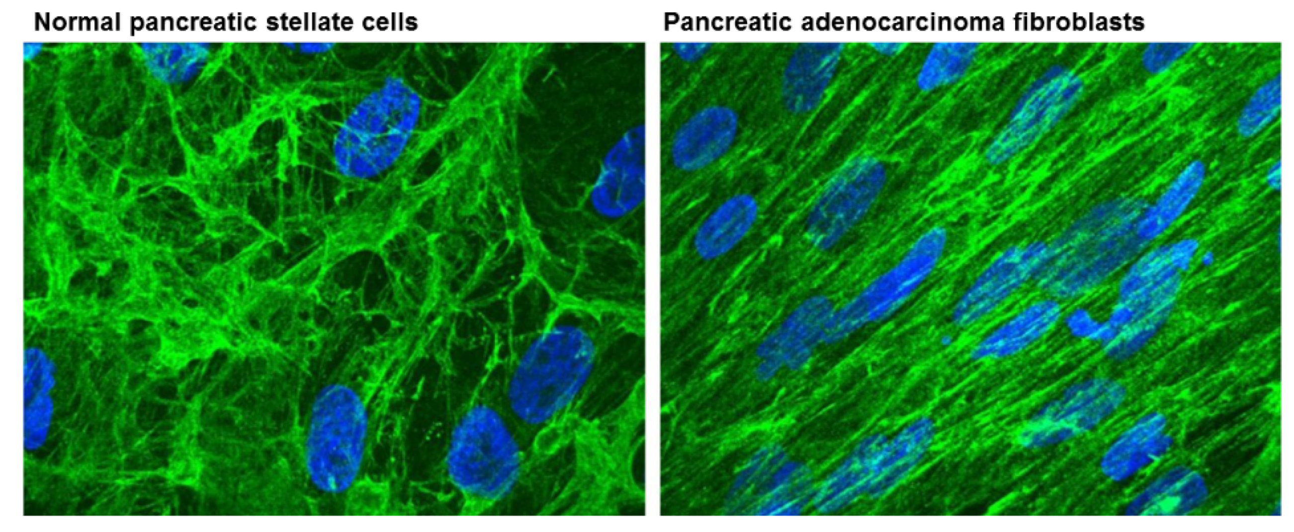 Cancers 13 01100 g003 Cancers 13 01100 g003