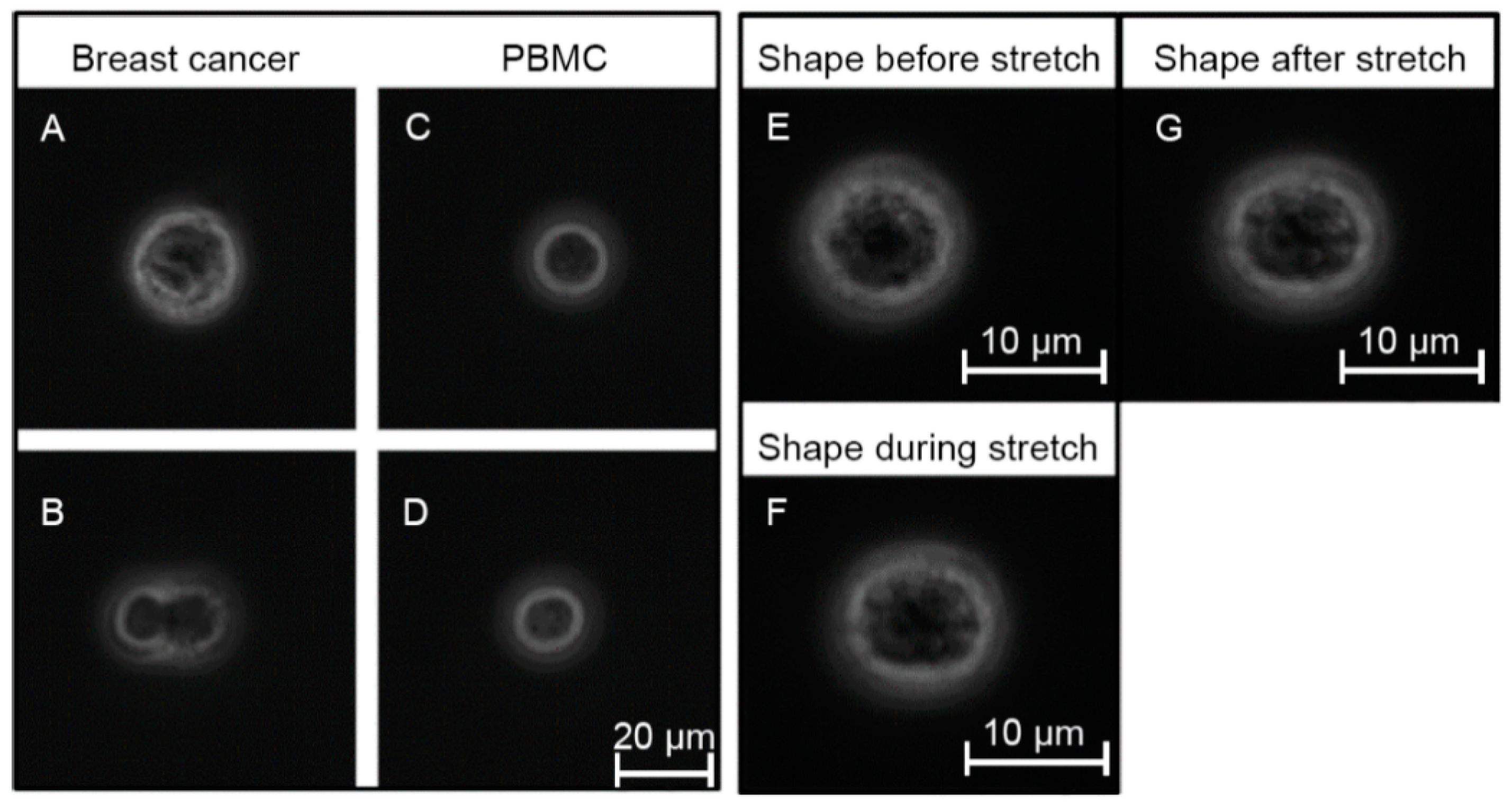 Cancers 13 01119 g004 Cancers 13 01119 g004