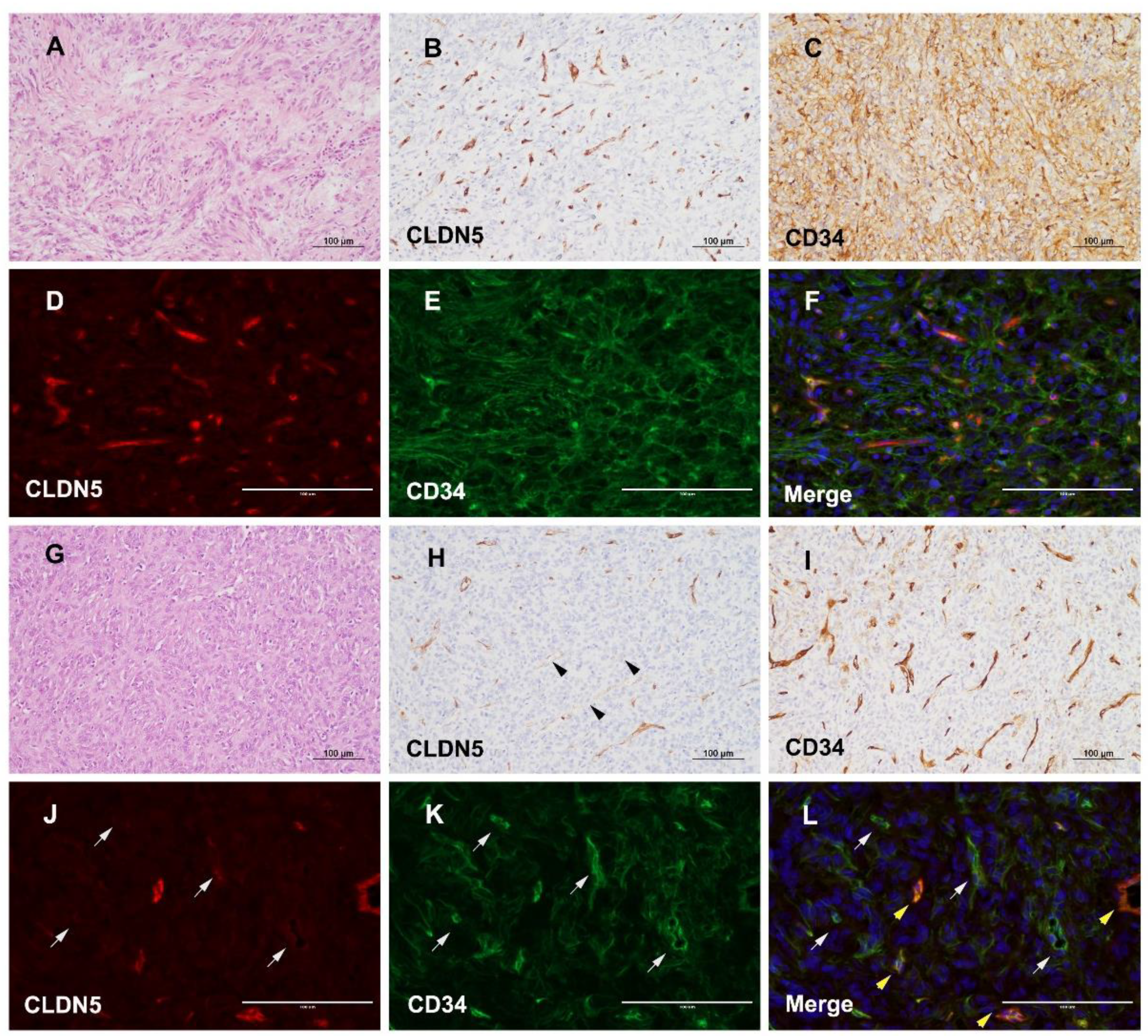 Cancers 13 01142 g004 Cancers 13 01142 g004