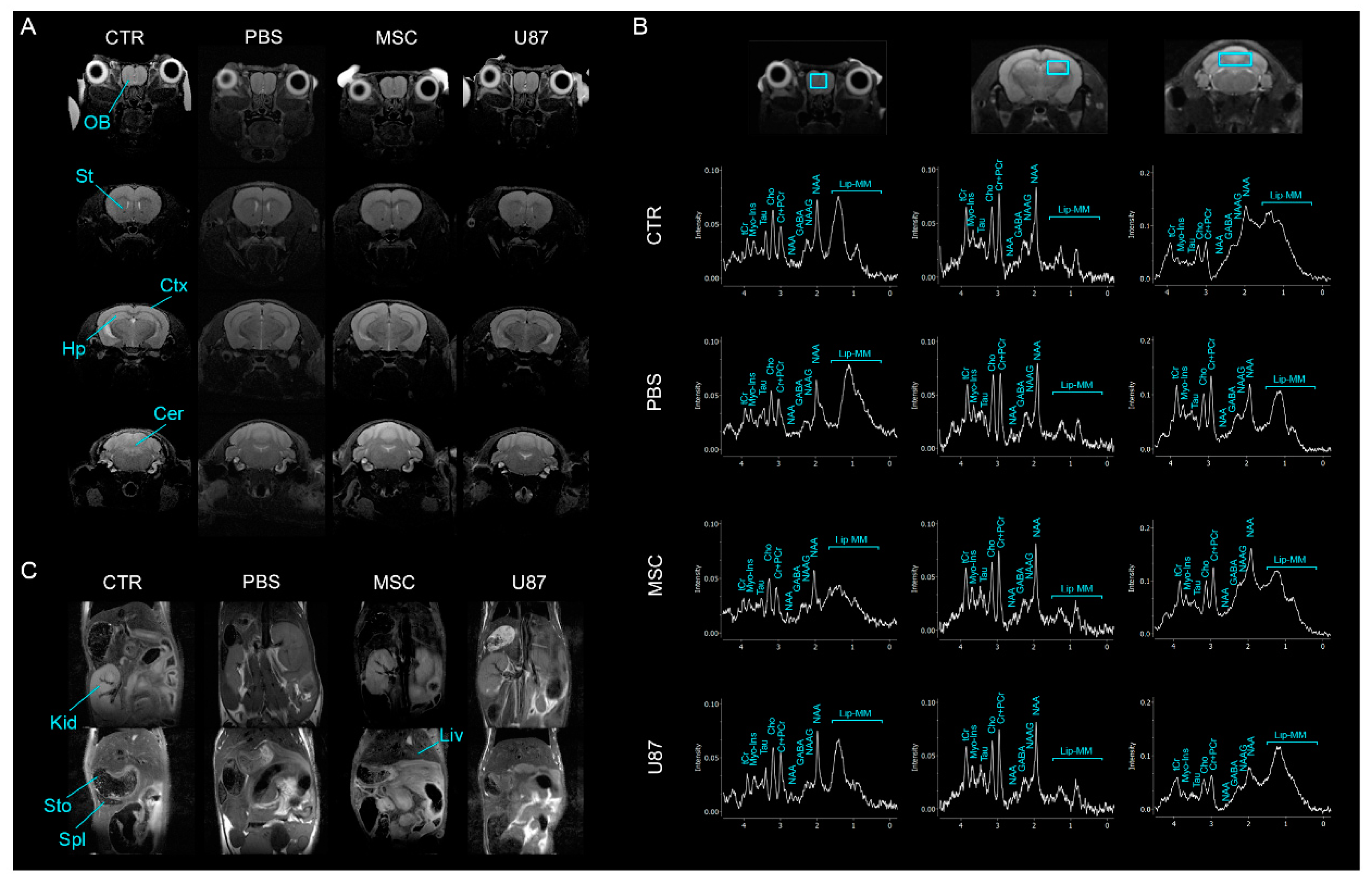 Cancers 13 01169 g004