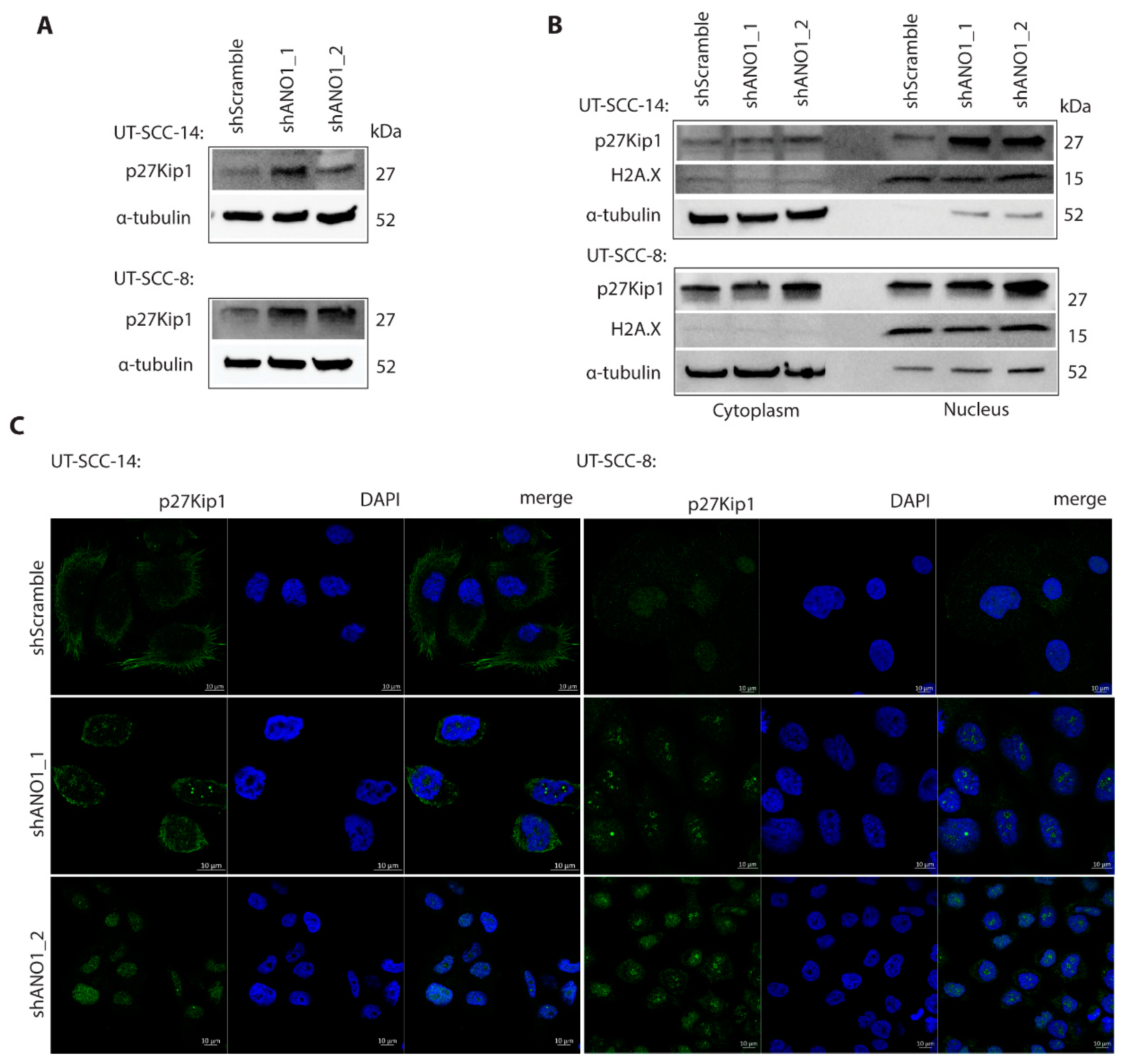 Cancers 13 01170 g004 Cancers 13 01170 g004